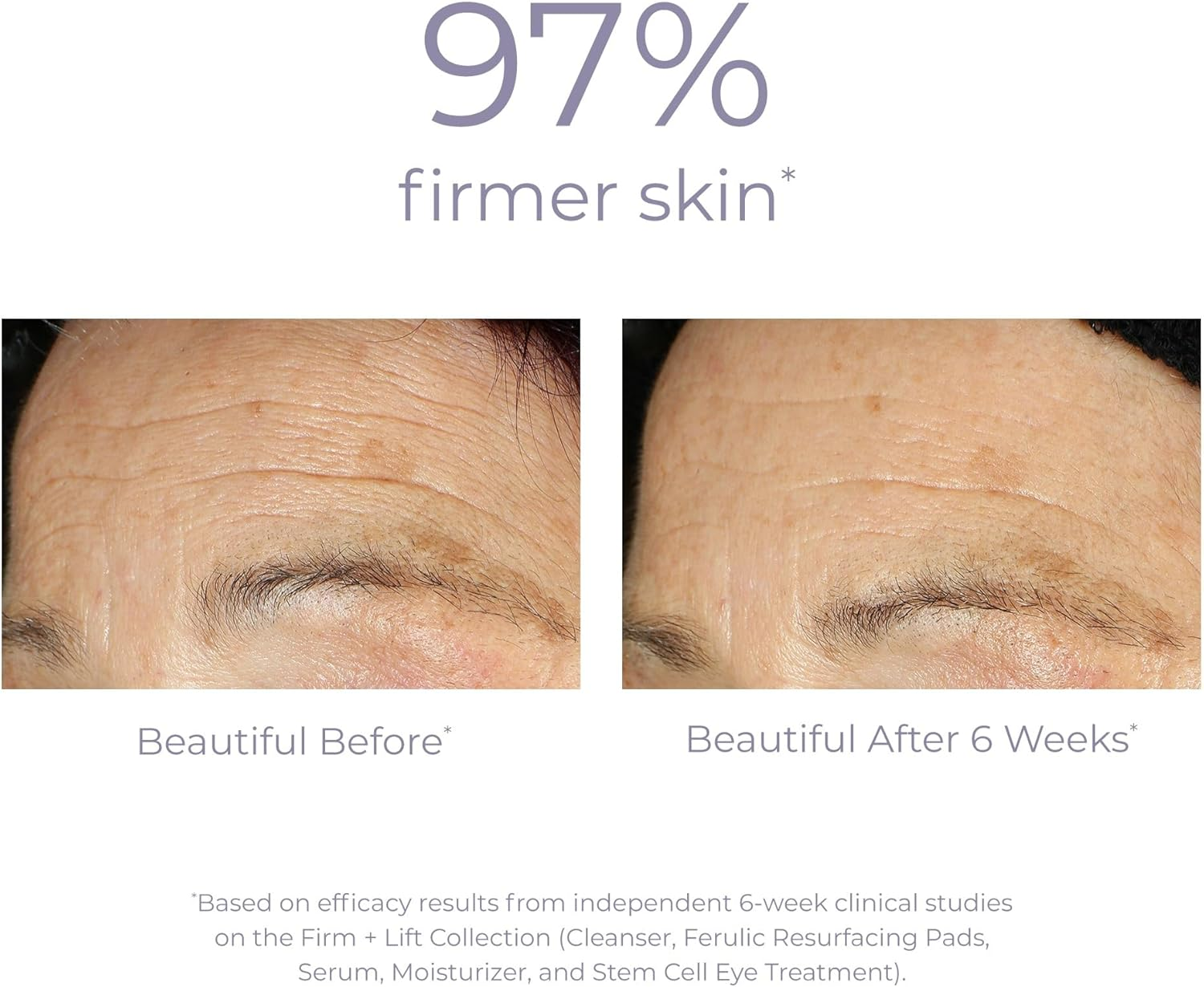 Derma E Ultra Lift DMAE Concentrated Serum, 29.57 Ml image number 4