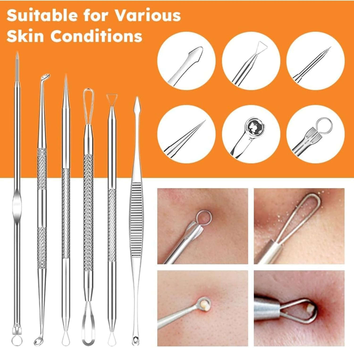 RODISHOMM 15-Piece Blackhead Remover Set - Pimple & Comedone Extractor, Acne & Whitehead Removal Tools, Premium Stainless Steel, Includes Silver Metal Case image number 5
