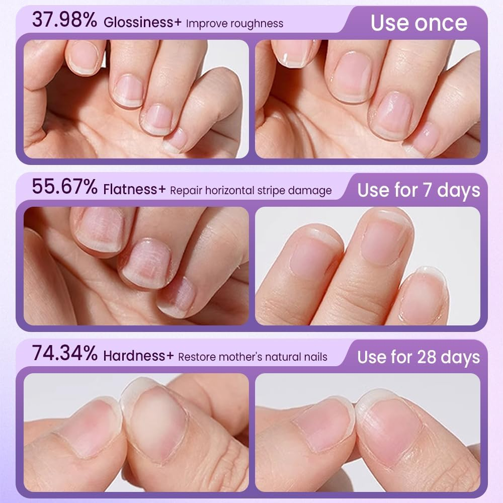 3-In-1 Nail Care Pen, 2025 Upgrade Cuticle Oil Pusher Nail Oil Pen with Ceramic Tip for Hangnails, Dry & Damaged Nails, Moisturize Strengthen Brighten Nails Care (3) image number 6