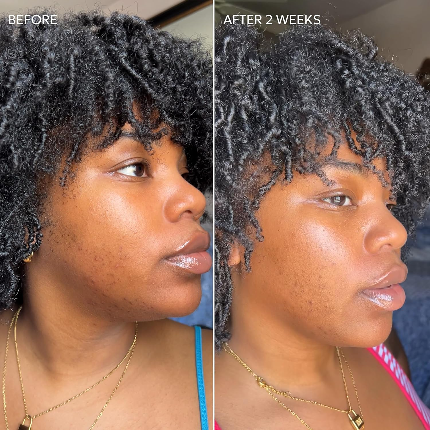 Skin Fade Cream by Dermisa for Unisex - 1.78 Oz Cream image number 3