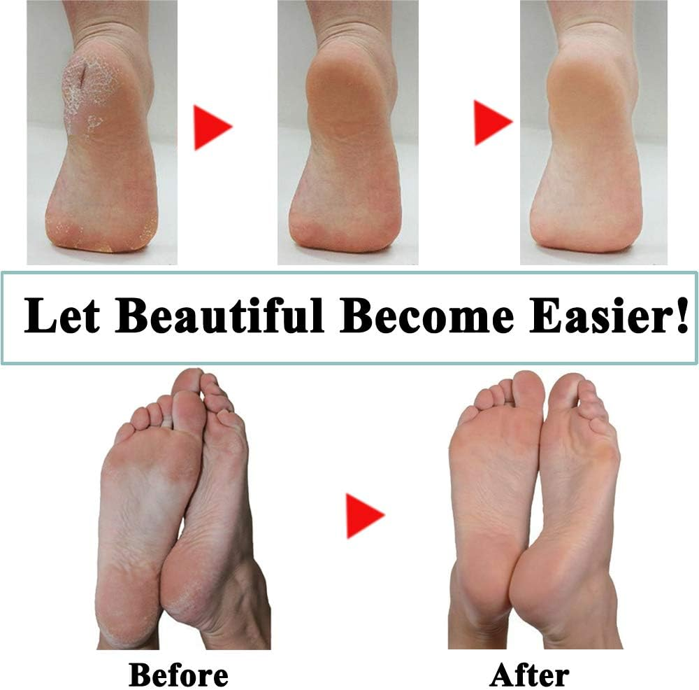 14 Extra Coarse Replacement Roller Refill Heads Compatible with Amope Pedi Refills Electronic Foot File image number 3