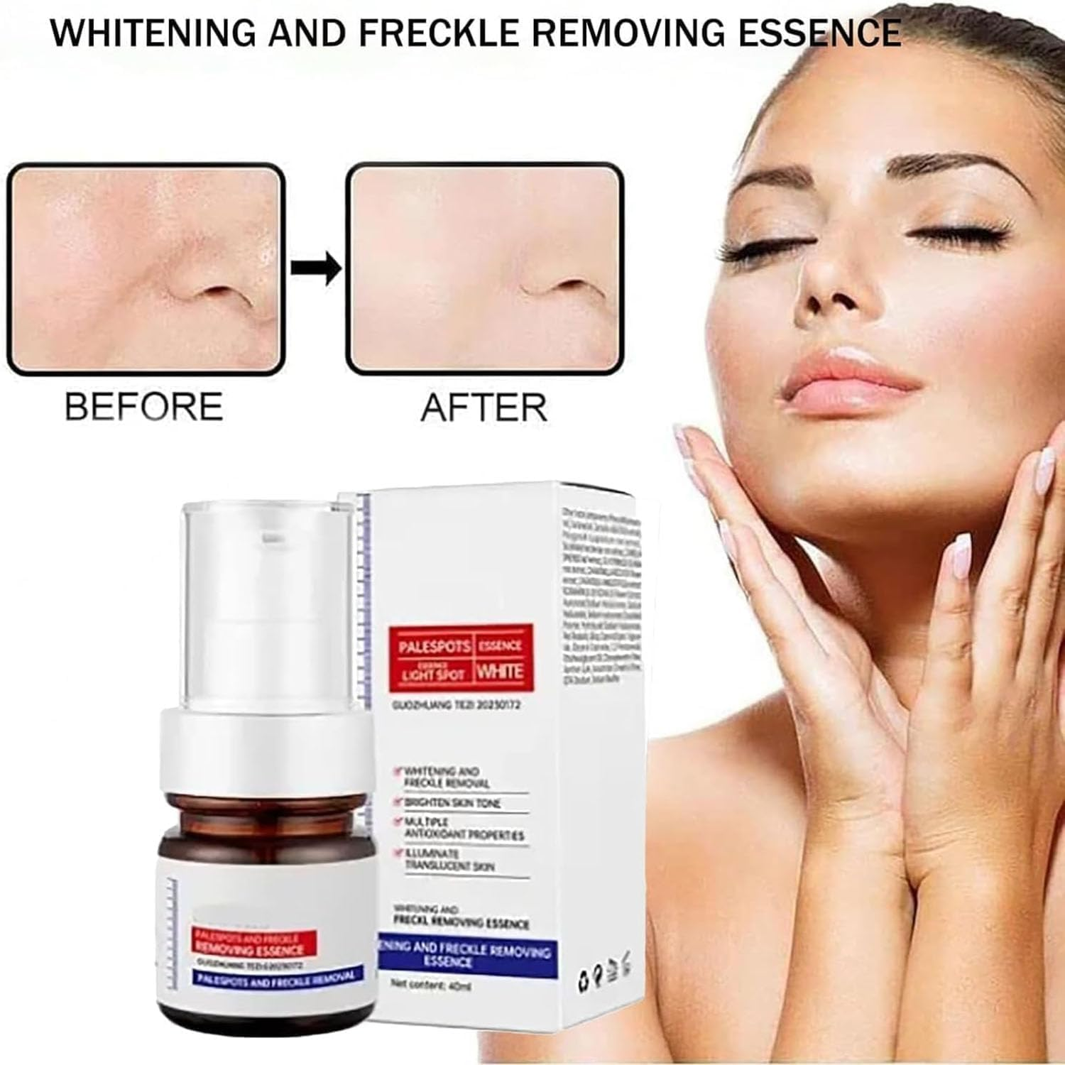 Whitening and Freckle Removing Essence, Dark Spot Removal Serum,Vitamin C Whitening Freckle Cream