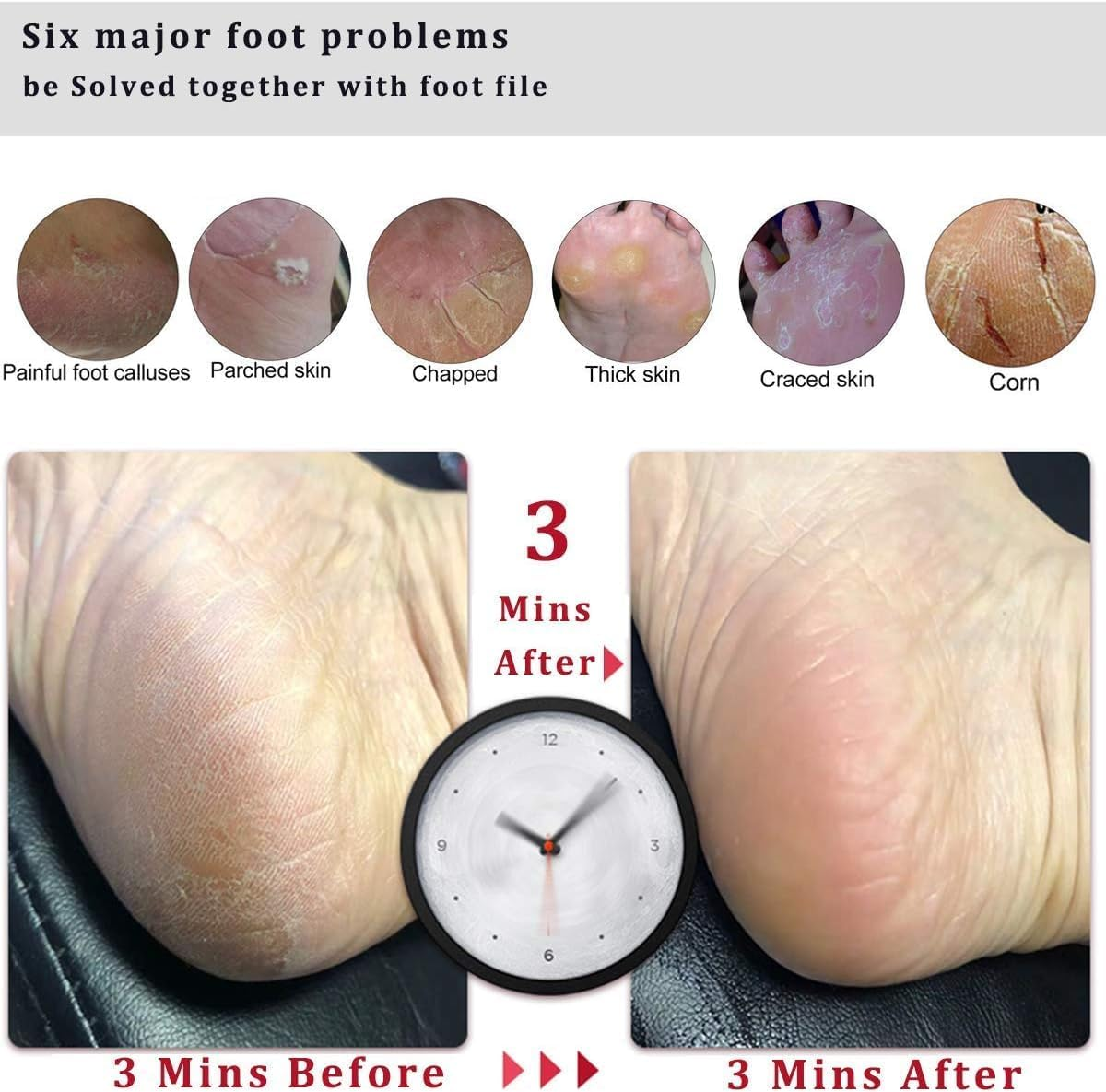 Professional Foot File Foot Scrubber Hard Skin Callus Remover Pedicure Foot Rasp,Can Be Use on Cracked Heels,Dead Skin,Corn,Pumice Stone for Feet Massager Scraper File Brush Tools 1Pcs image number 1