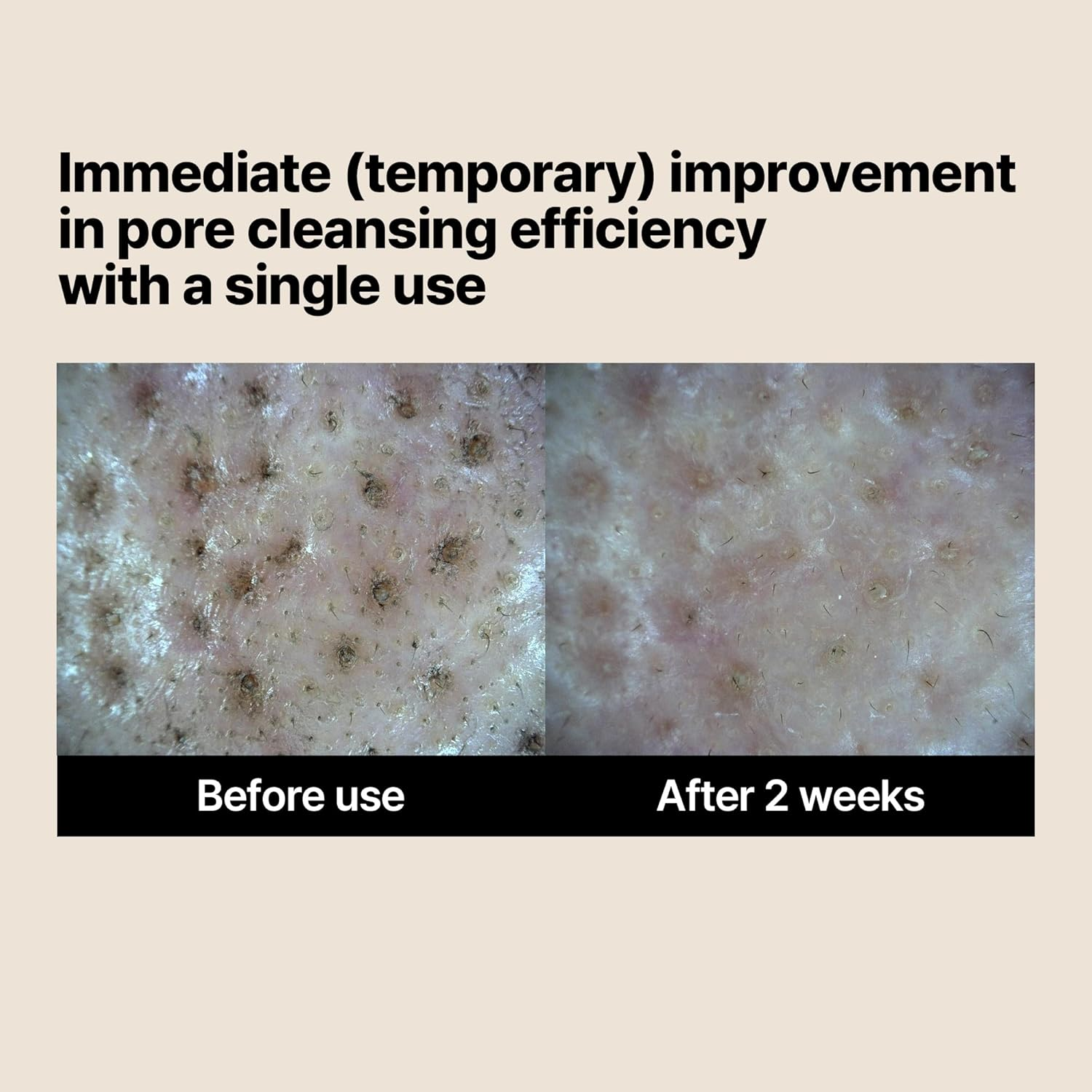 SOME by MI Lactosoy Enzyme Deep Cleansing Foam 100 Ml image number 2