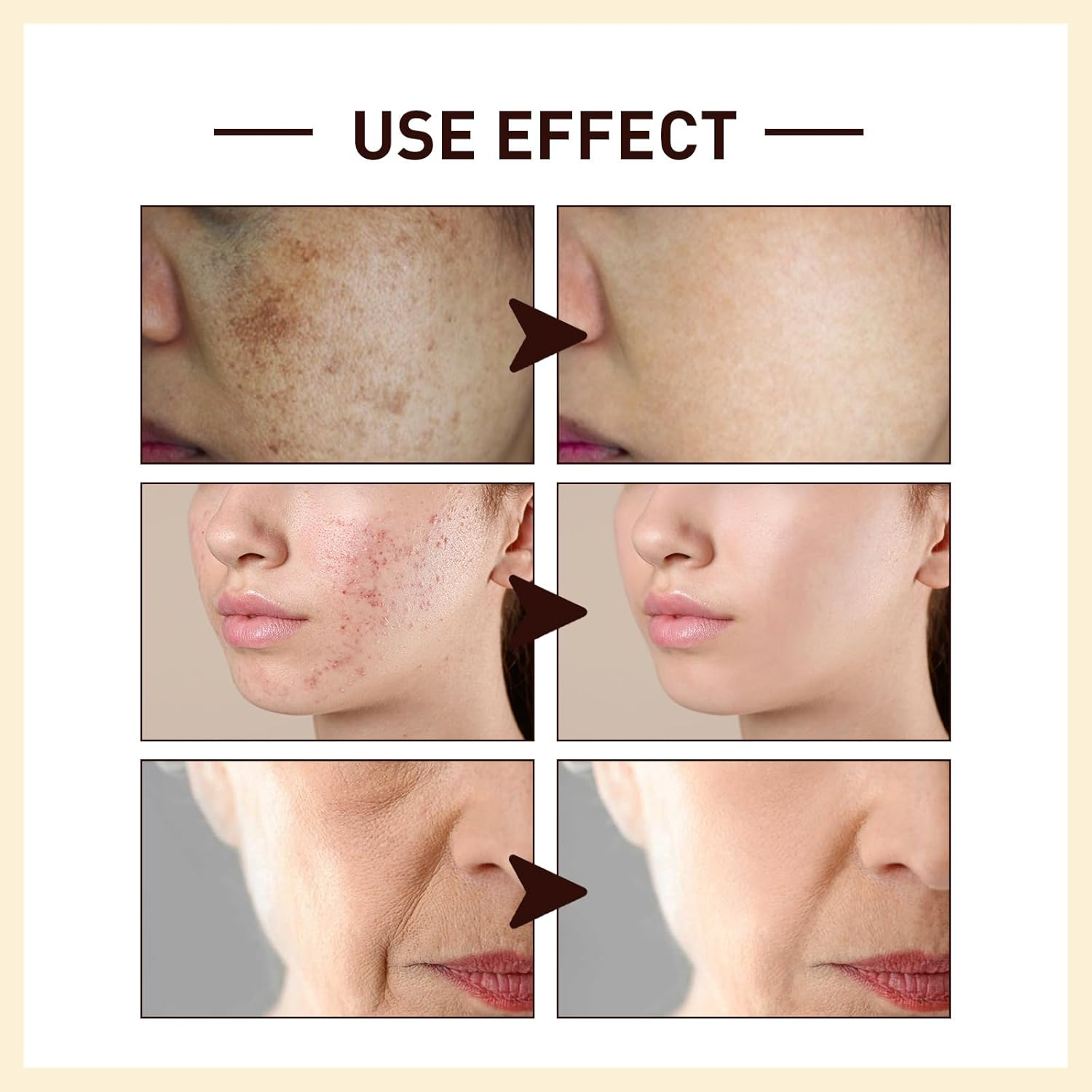 Anti-Wrinkle Rice Whitening Face Serum &mdash; Hydrating & Nourishing Rice Essence with Niacinamide & Hyaluronic Acid, Firming Moisturising Solution for Dark Spot Correction & Even Skin Tone (1 PCS) - 1 Pcs image number 5