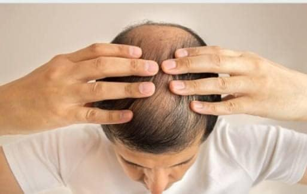 ONILEAVES Onion Hair Oil for Boosting Hair Growth and Controlling Hairfall | 100Ml | Comes with a Comb to Enhance Easy Application image number 4