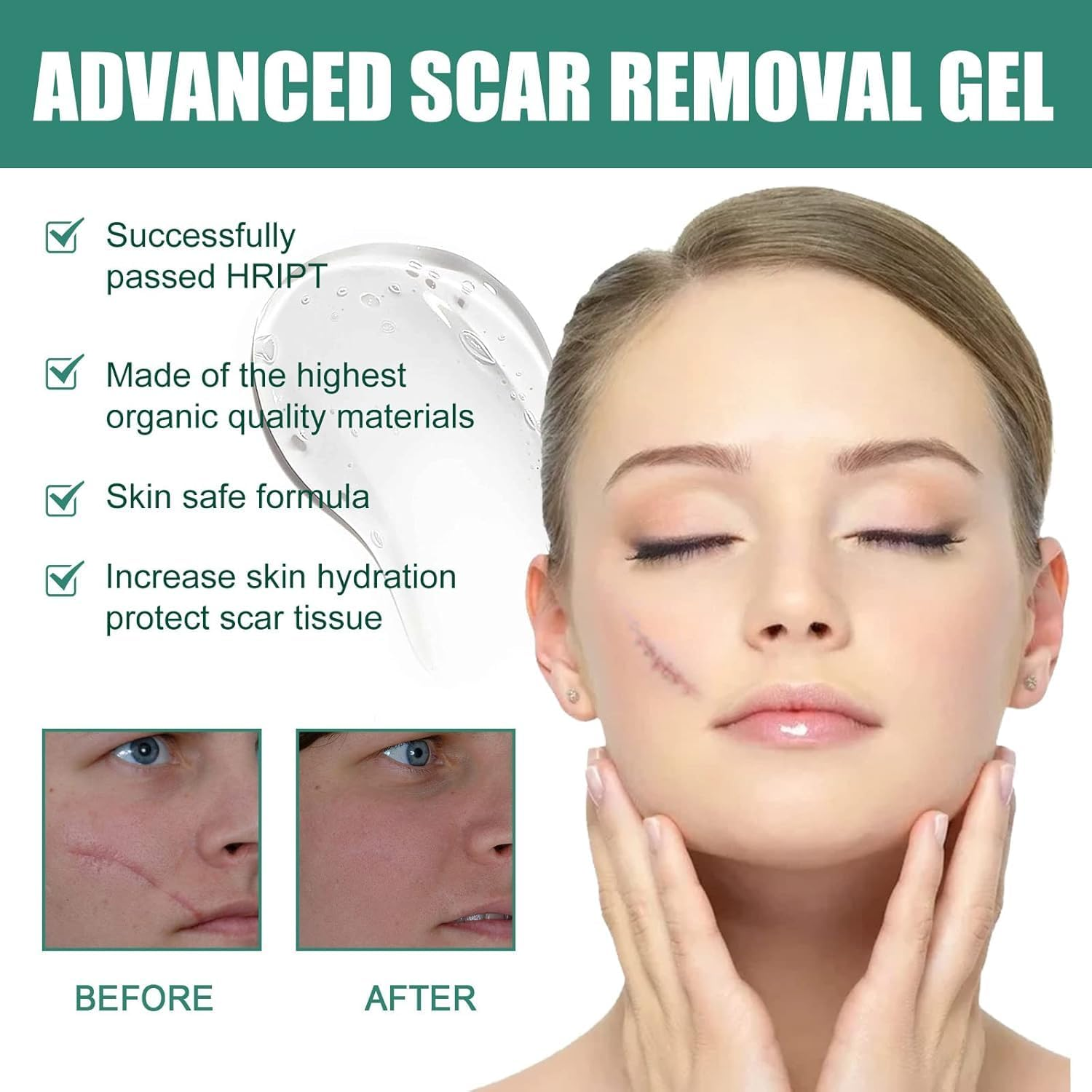 Organic Natural Tummy Leg Facial Scar Cream Pimples Stretch Marks Remove -Strong Effective Acne Scar Removal Cream,Lightweight Daily Moisturizer for Face & Body, Fast Absorbing, Non-Greasy Hydration, Gentle Skincare for All Skin Types &ndash; 50 Ml / 1.7 Fl Oz image number 3