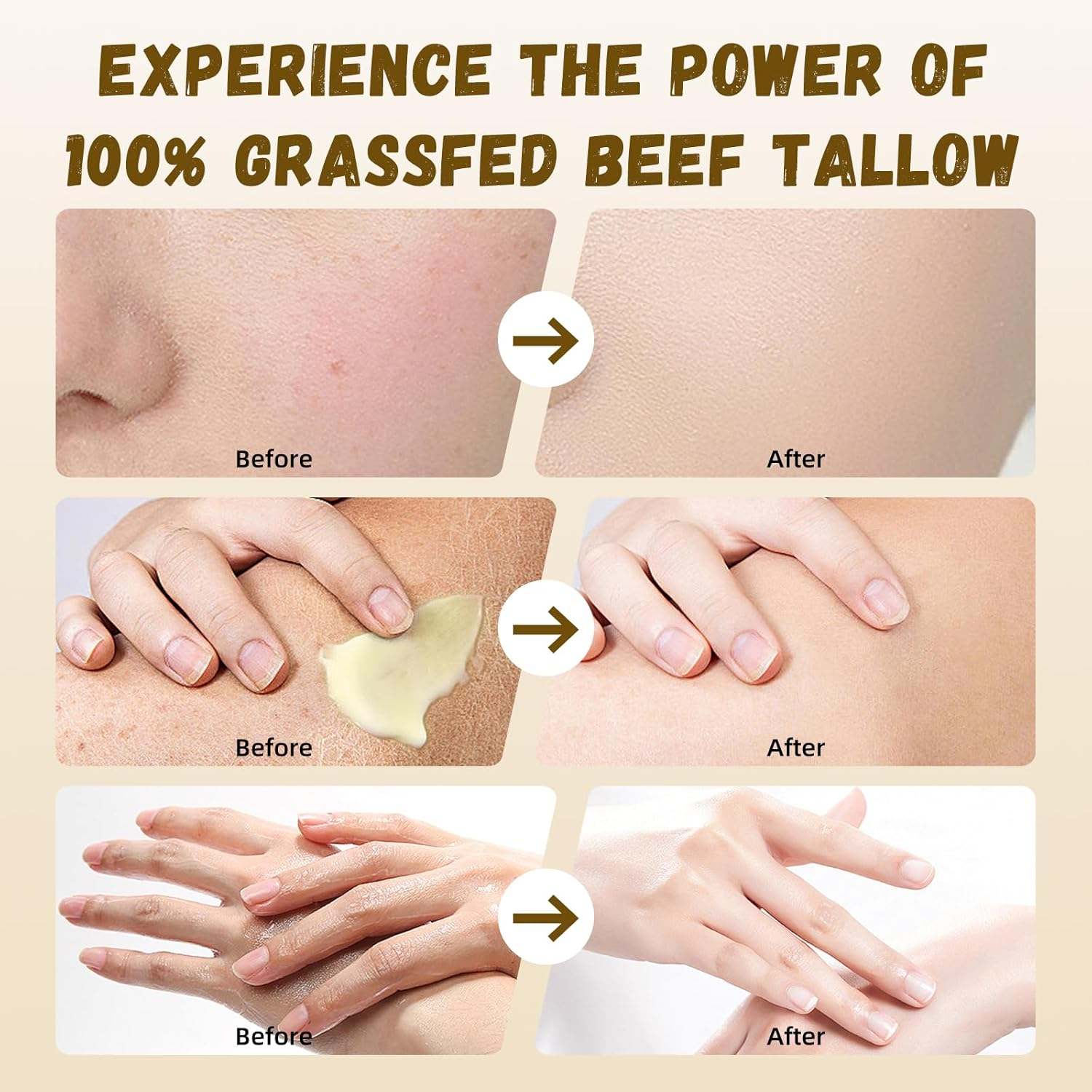 Beef Tallow for Skin, Beef Tallow and Honey Balm, Beef Tallow Face Moisturizer Hydrates and Nourishes the Skin, Whipped Tallow Honey Balm Natural Beef Tallow Lotion for Body Skin Care(2.470Z)