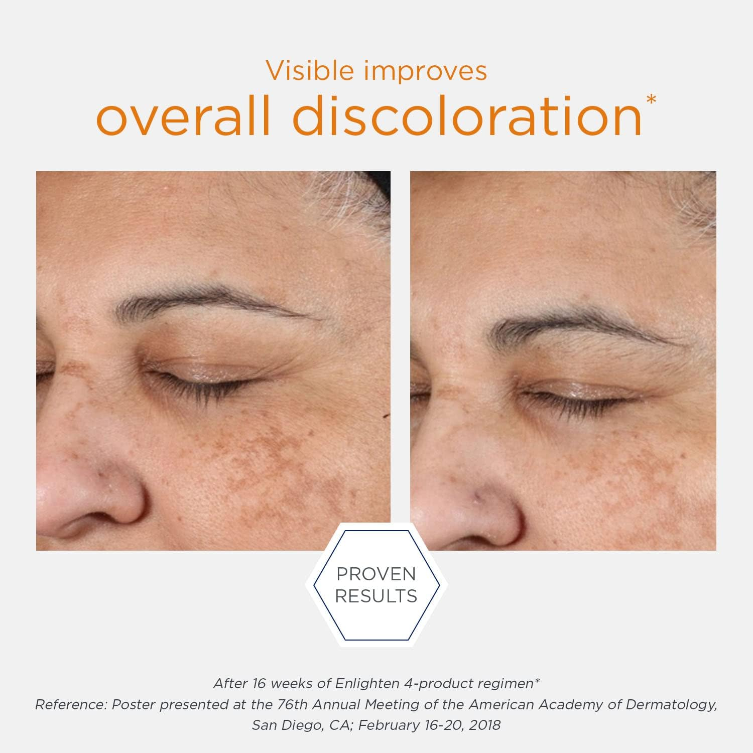 Neostrata Enlighten Illuminating Serum 30 Ml image number 4