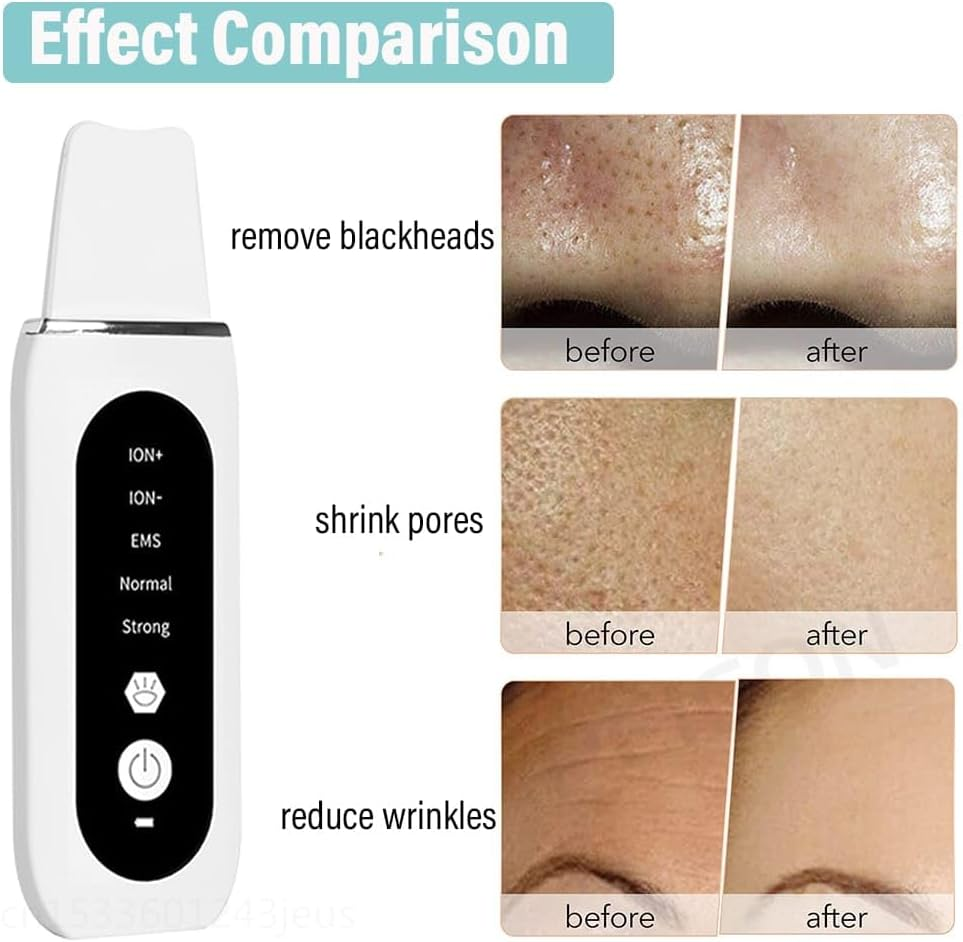 Ultrasonic Skin Scrubber Peeling Blackhead Remover Deep Face Cleaning Ultrasonic Ion Ance Pore Cleaner Facial Shovel Cleanser image number 4