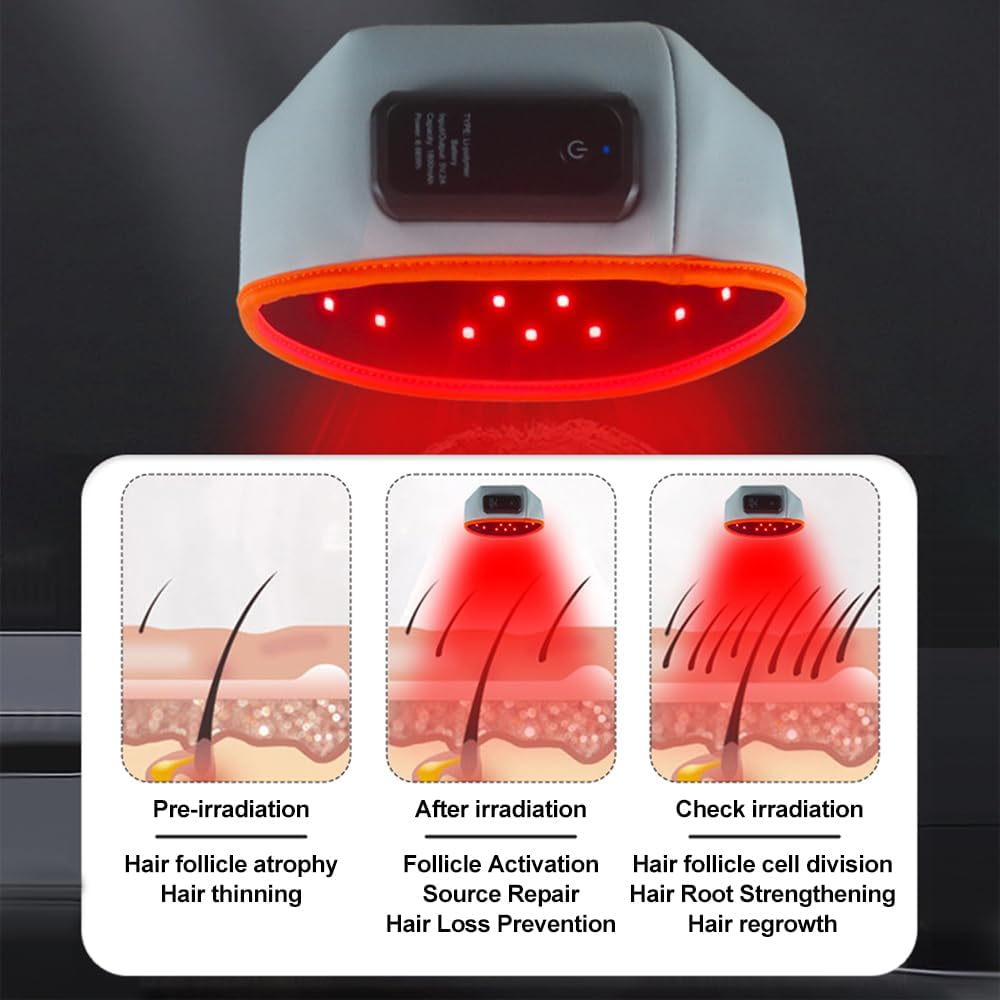 Red Light Hair Growth Beanie, Revitalize Your Hair with the Power Laser Hair Growth Cap, Red Light Laser Hair Growth Cap, Red Light Hair Growth Hat (Wireless) image number 4