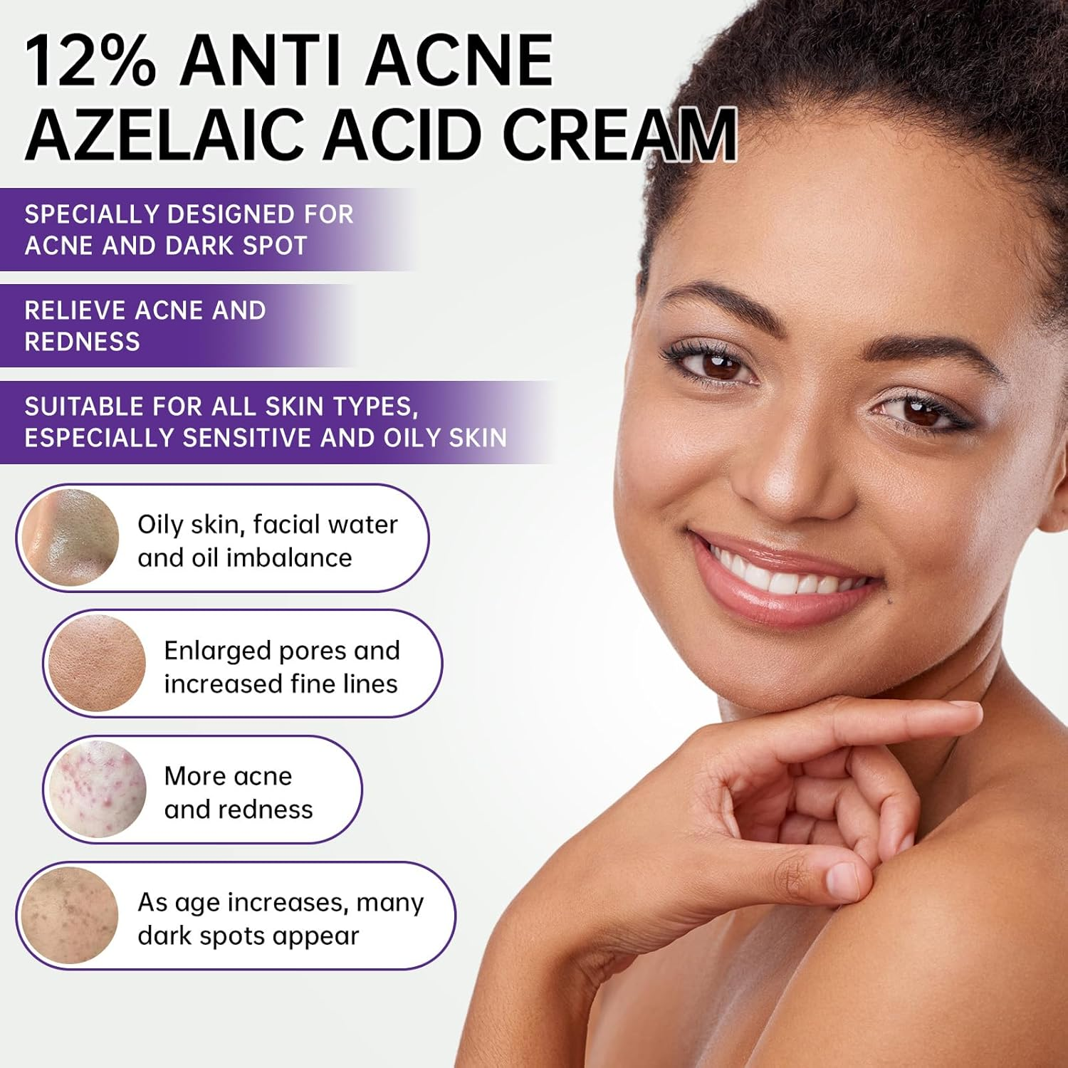 Azelaic Acid 12% Cream for Face, Azelaic Acid Acne Cream for Redness Relief, 0.7 OZ Azelaic Acid Gel with Salicylic Acid & Niacinamide for Dark Spot, Skin Care. image number 1