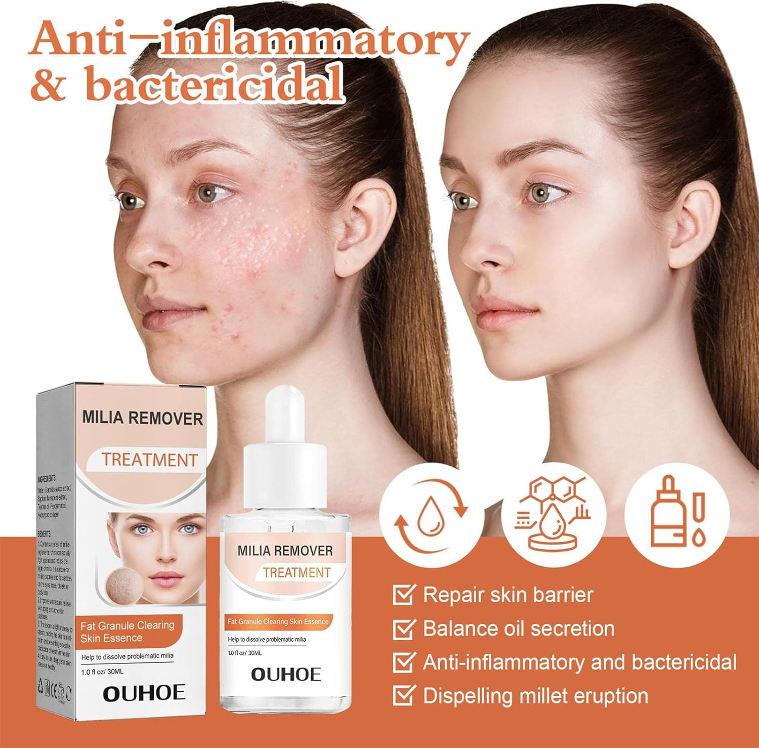 Milia Remover - 30Ml Gentle and Safe Milia Remover for Fat Granule Clearing - Milia Spot Skin Care Product Helps Dissolve and Reduce Milia, Works Face And image number 5