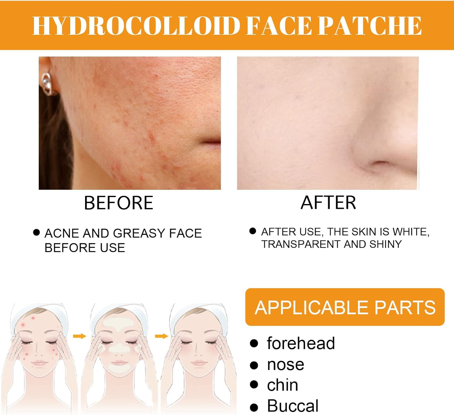 Pimple Patches for Face,Hydrocolloid Surface Patches for Forehead,Nose,Chin and Cheeks,Large Acne Treatment Patches for Pimple Extraction and Clean Pores,Hydrocolloid Acne Patches for Acne Skin image number 4