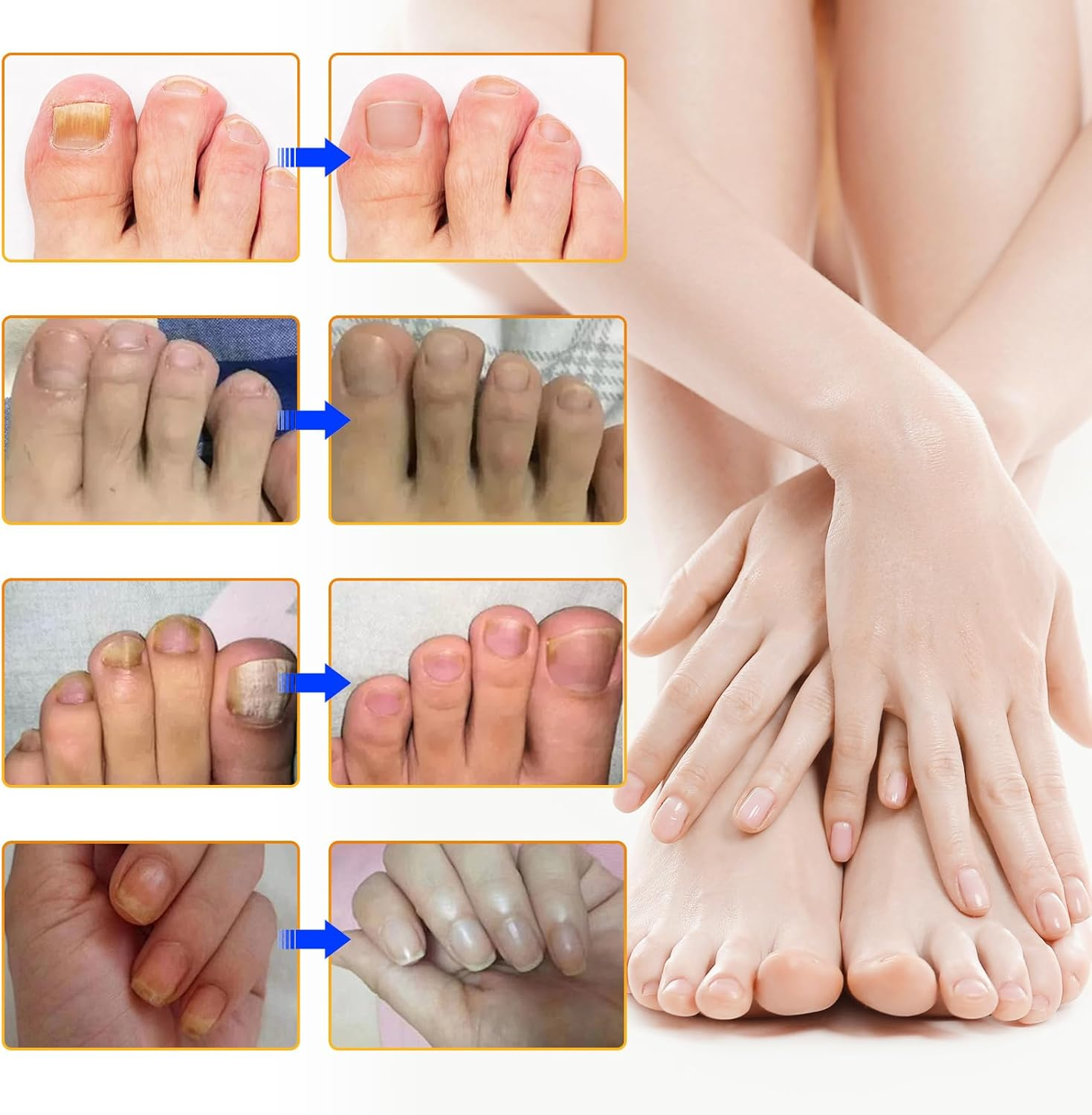 Nail Treatment Patches, 24 Pcs Discolored Thickened Nails Repair, 8 Hour Nightime Nail Renewal Waterproof for Men Women image number 3