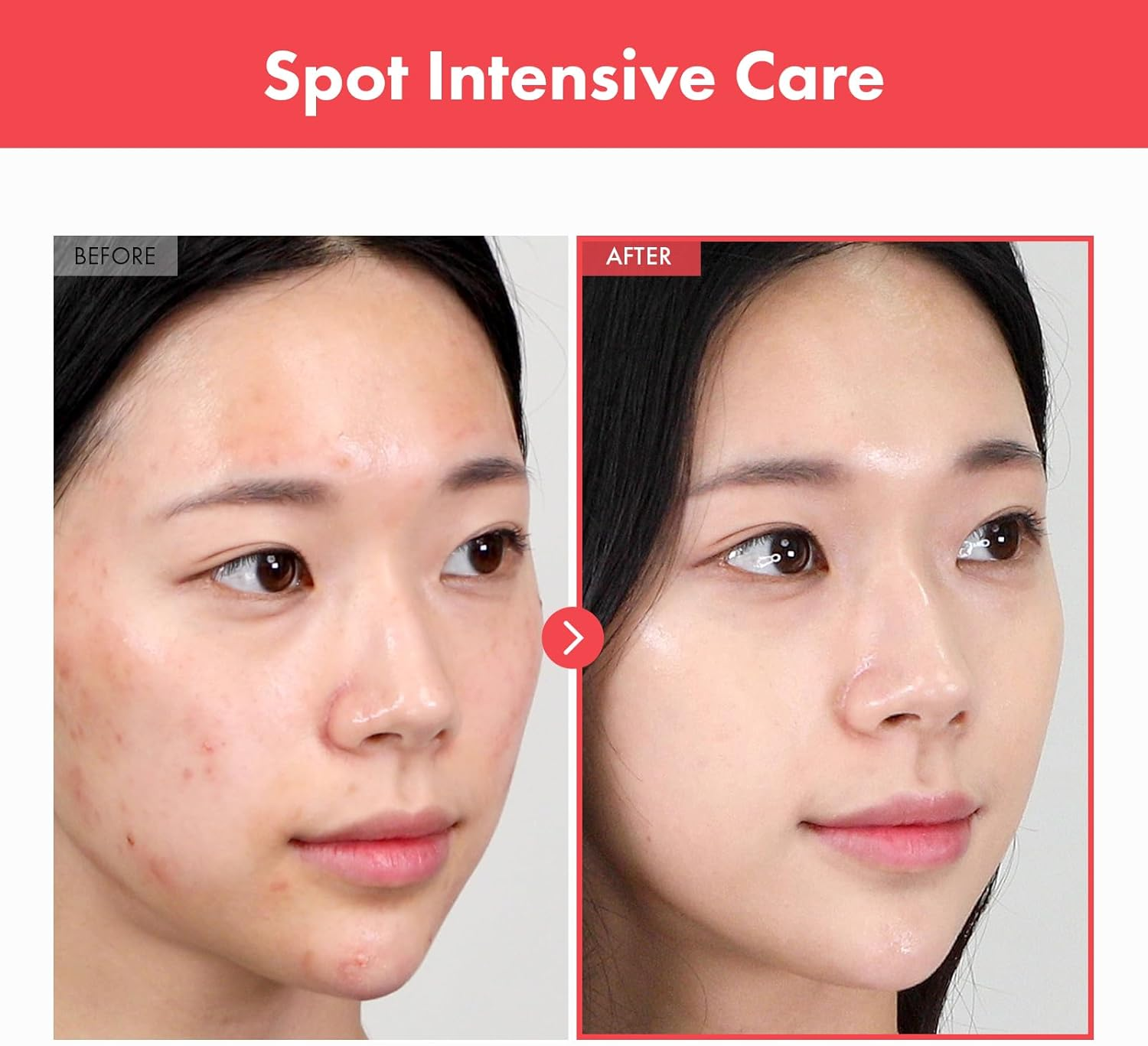 TOSOWOONG Ovalicin Skin Clear Cream, Skin Soothing, Moisturizing with Niacinamide and Sulfur, Korean Skincare, 50G, 1.76 Oz. image number 2