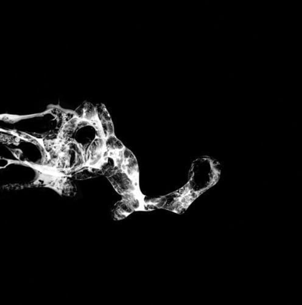 Tourette Tourette image number 2