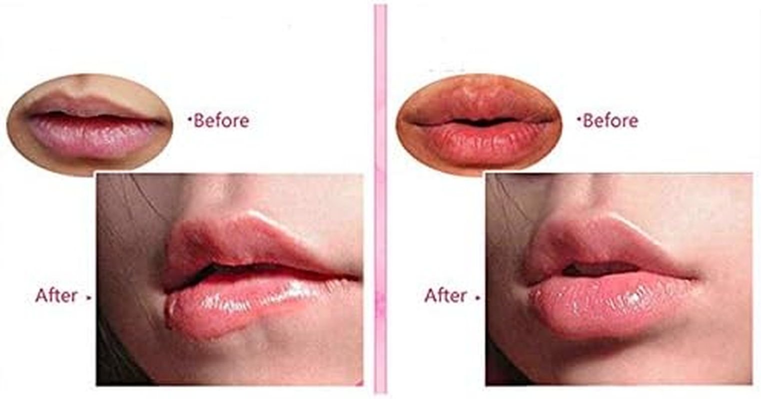 Ccbeauty 30 Pieces Pink Collagen Crystal Lip Mask Lip Plumper Mask Gel Care Mask Moisturer Essence Make Your Lip Attractive and Sexy