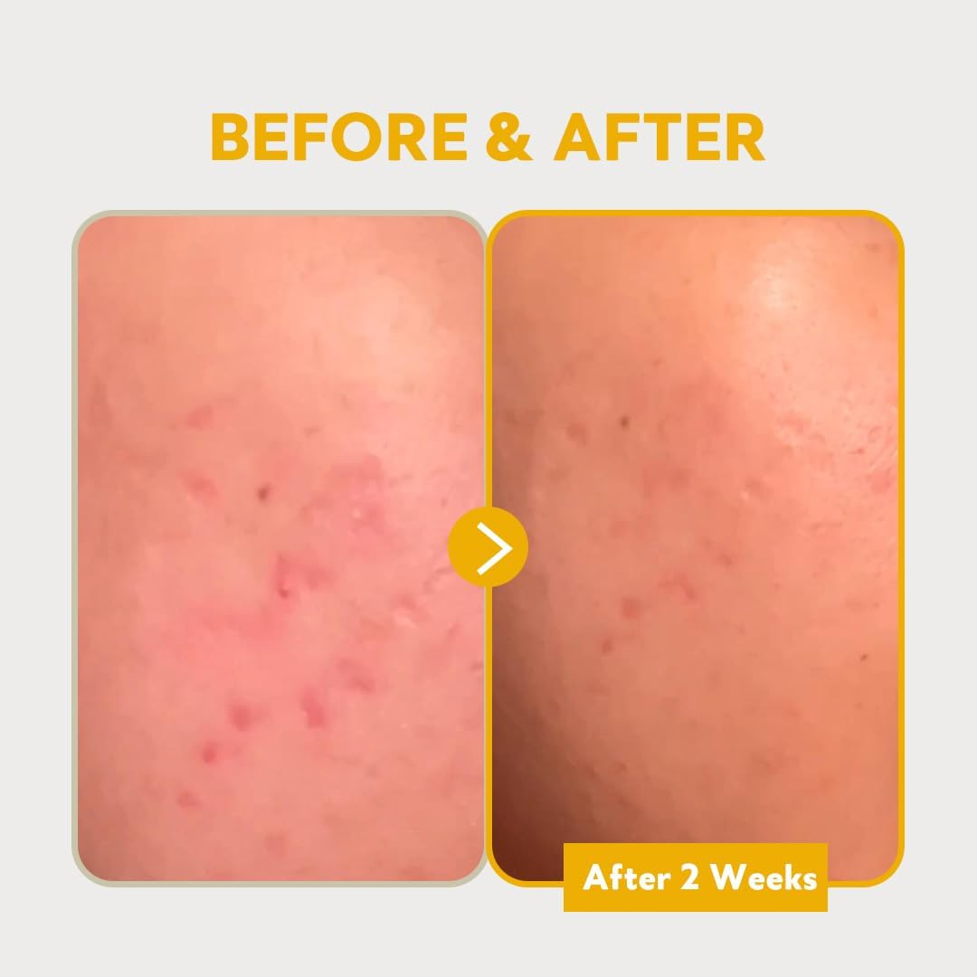 PURE VITAMIN C24 Serum30Ml image number 2