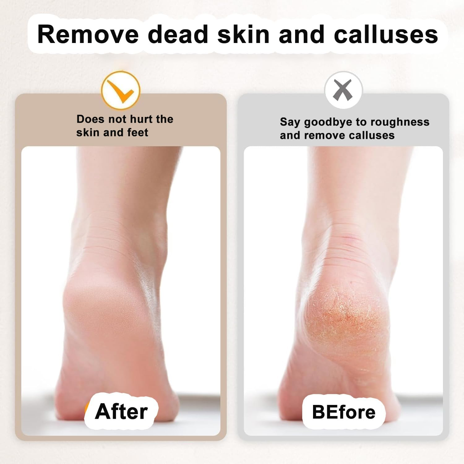 Callus Remover Replacement Rollers Extra Coarse Mineral Diamond Particles Pack of 12 3 Roughness Levels image number 2