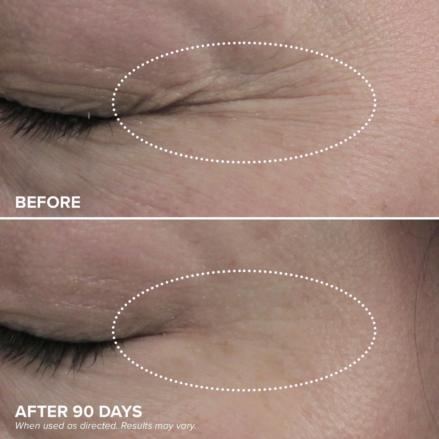 DRMTLGY HPR Eye Cream - Retinoid under Eye Cream for under Eyes, 0.5 Fl Oz image number 5