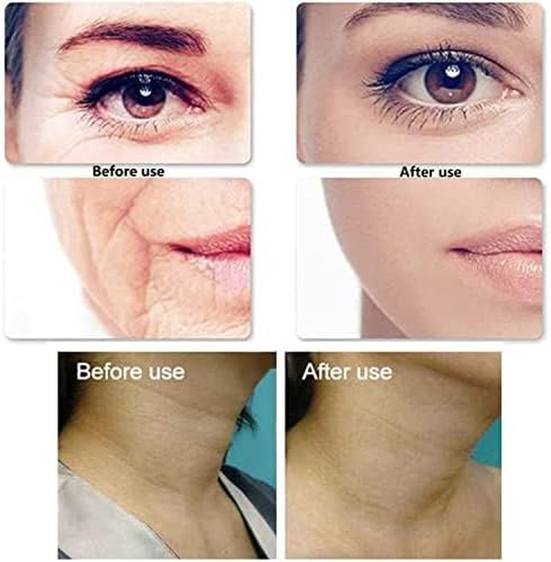 16Pcs Silicone Anti-Wrinkle Patches for Forehead, Eyes and Chin, Washable and Reusable for Enhance Skin Elasticity and Lift Skin image number 4