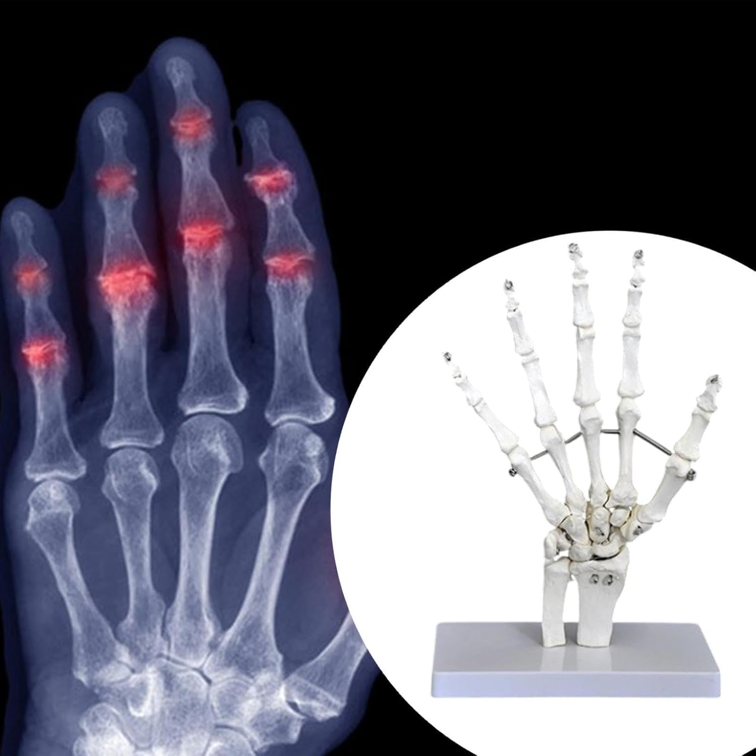 Eigell Human Joint Model for Educational Purposes, Medical Display Tool, Skeleton Structure for Science Learning, Hand image number 4