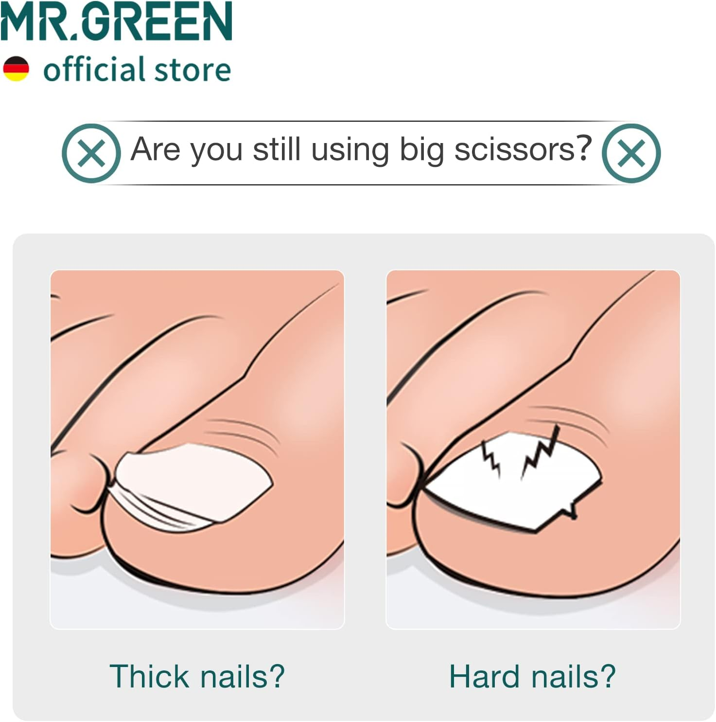 MR.GREEN Toenail Clipper Stainless Steel Ingrown Nail Cutter Good at Cutting Thick and Hard Nails Pedicure Tools (Orange+Nail Remover) image number 2