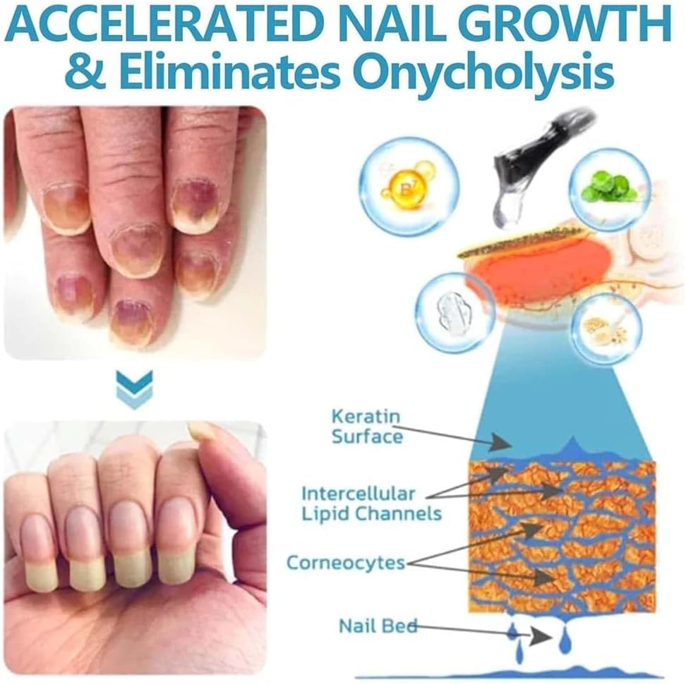 Onyxoguard Nail Growth and Repair Serum,Natural Formula Nail Serum Nail Growth Oil,Nail Growth and Repair Serum (2Pcs) image number 3