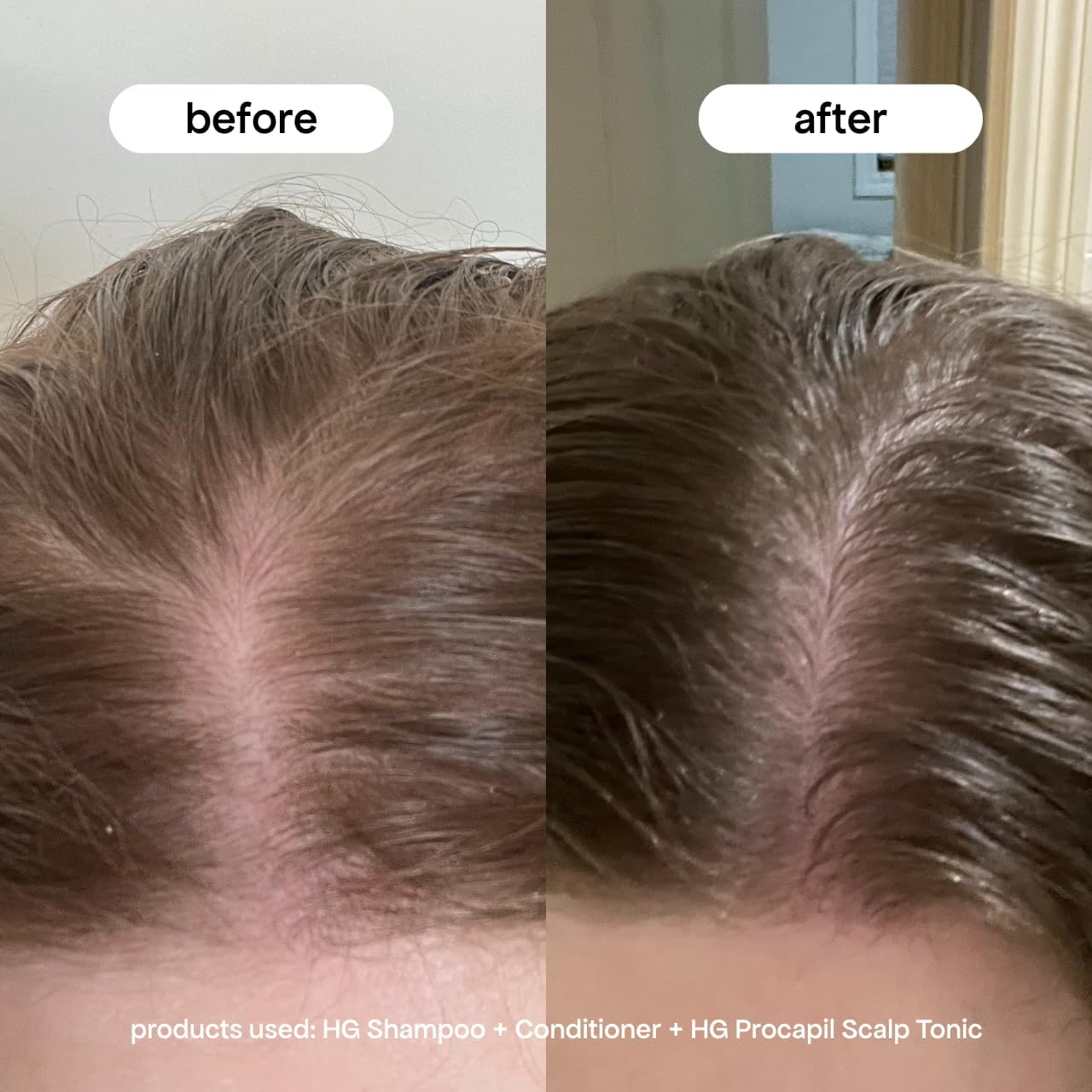 Bondiboost Procapil Hair Tonic 4.23 Fl Oz - Leave-In Treatment for Thinning Hair - Reduce Hair Fall + Increase Hair Density - Lightweight Non-Greasy Formula - Vegan/Cruelty-Free - Australian Made image number 6