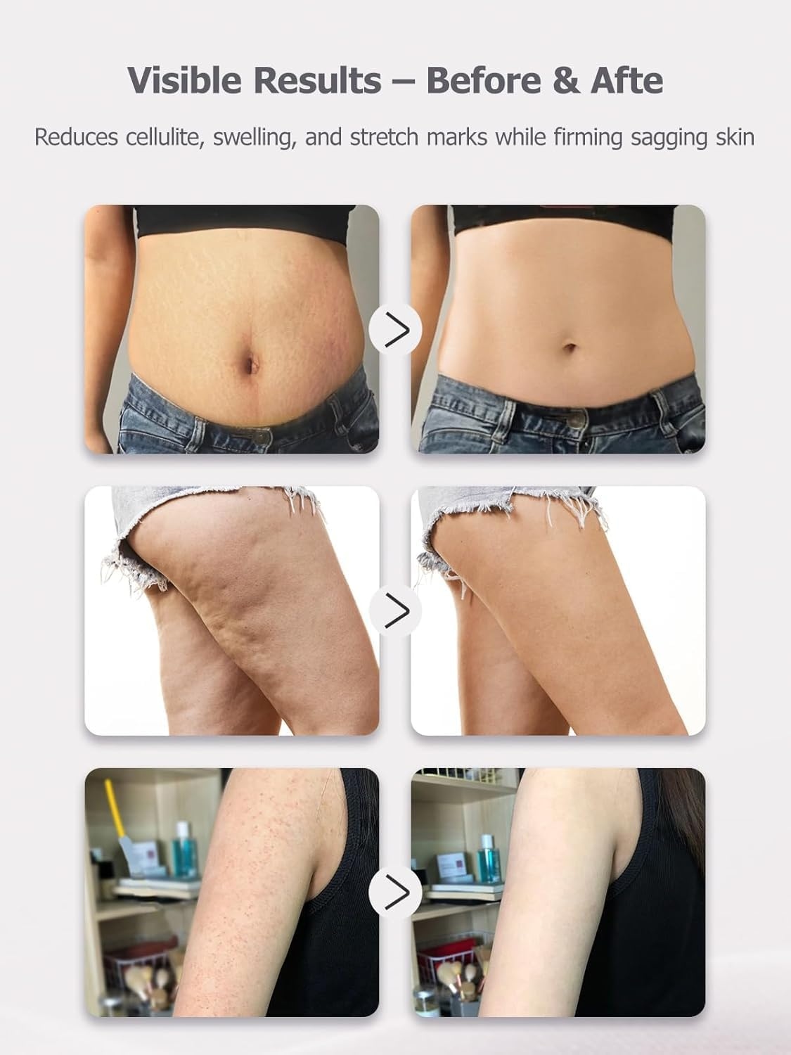 Lymphatic Drainage Massager, anti Cellulite Massage Tool, USB Charging Helps Reduce Stretch Marks Cellulite, for Legs, Arms, Belly, Body Sculpting Machine with Microcurrent, Light, Heat Vibration (White) - White image number 5