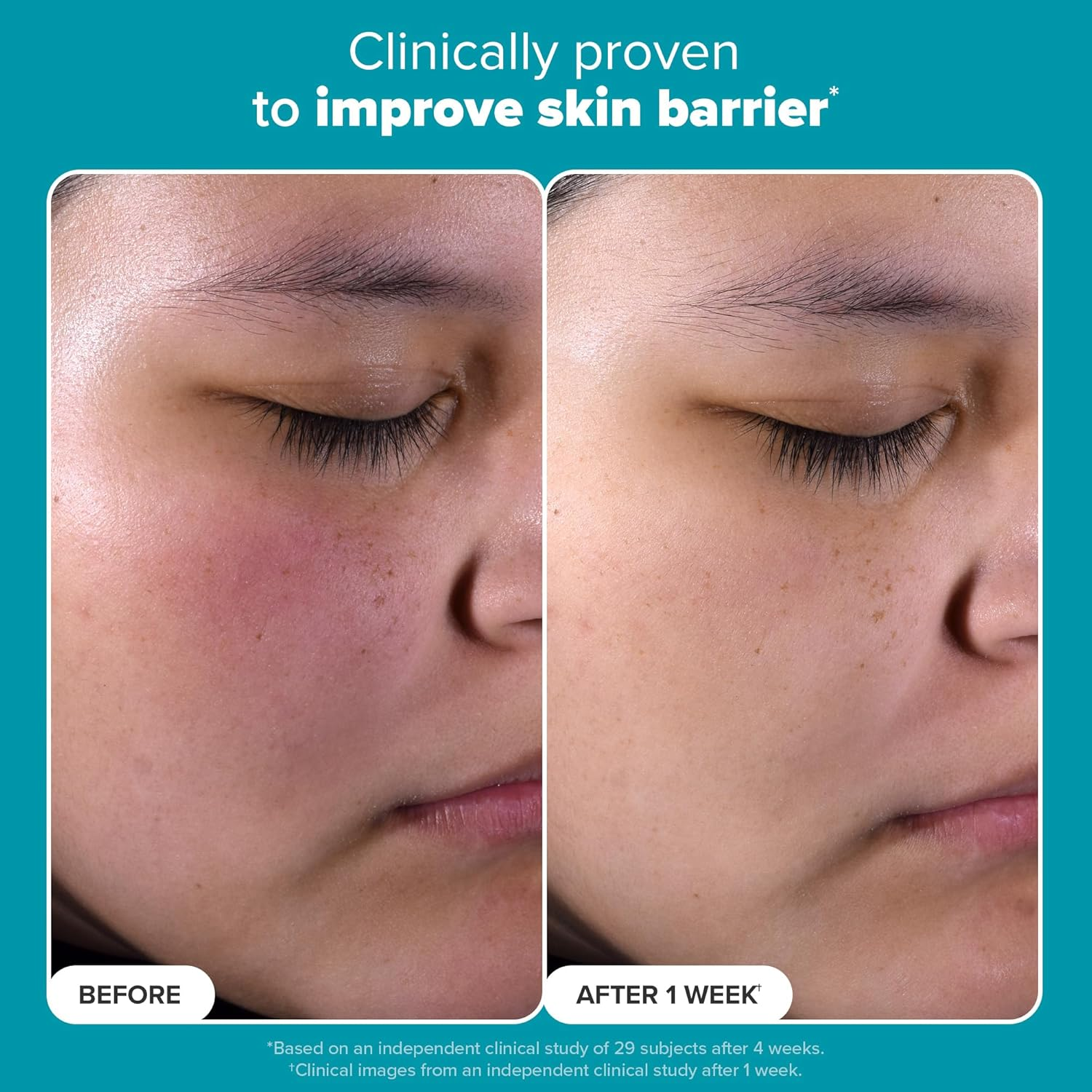 Paula'S Choice Skin Perfecting 2% BHA Liquid Salicylic Acid Exfoliant, Gentle Facial Exfoliator for Blackheads, Large Pores, Wrinkles & Fine Lines, Travel Size, 30 Ml Bottle image number 3