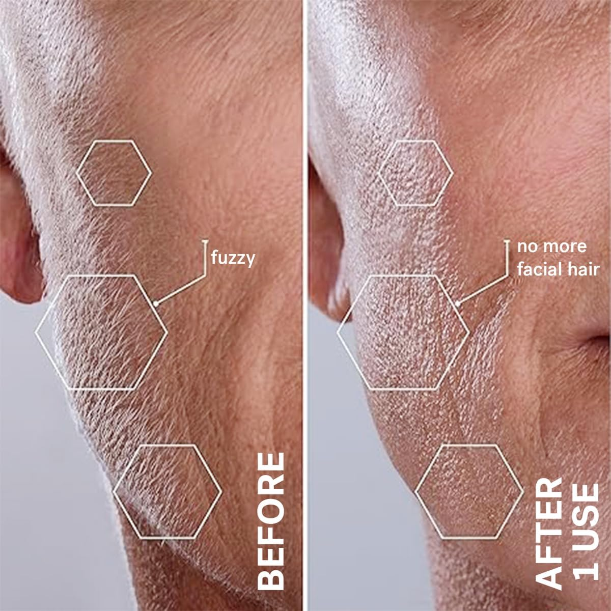 Michael Todd Beauty Sonicsmooth Pro+ Dermaplane Razor for Women Face + Eyebrow Trimmer Dermaplaning System W/Led Light Peach Fuzz Remover -16 Dermaplaning Blades & 2 Microsmooth Exfoliation Tips - Pink image number 2