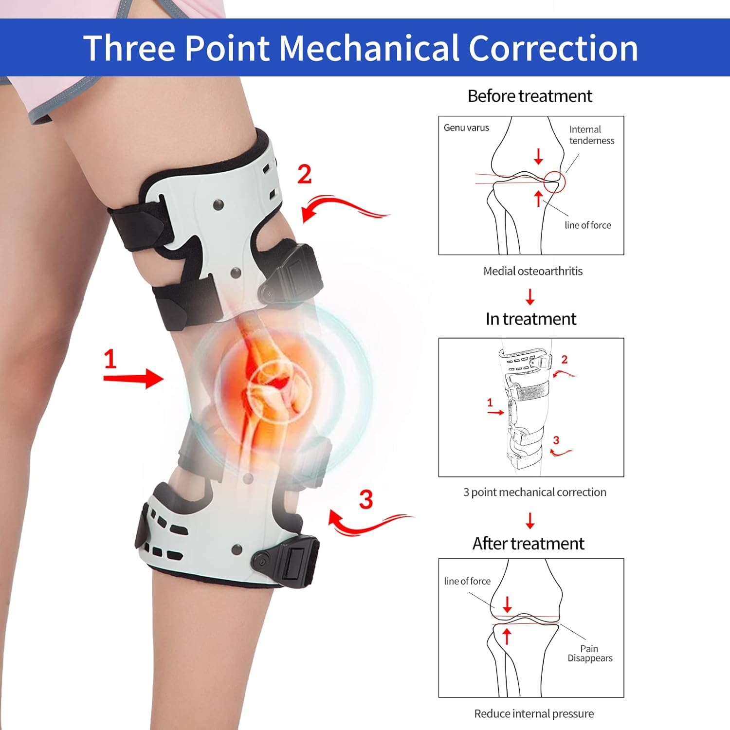 OA Unloader Knee Brace, OA Knee Brace Medial Unloader Knee Support for Osteoarthritis, Arthritis Pain, Avascular Necrosis, Bone on Bone Knee Joint Pain and Degeneration (Left) image number 3