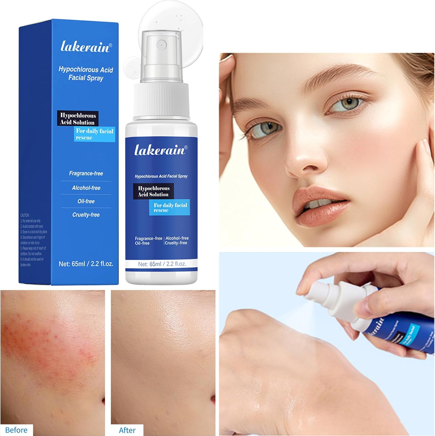 Hypochlorous Acid Spray Facial Toner, 65Ml Skin Renew Toner and Pure Hypochlorous Acid Spray Face, Moisturising for Sensitive Skin image number 6