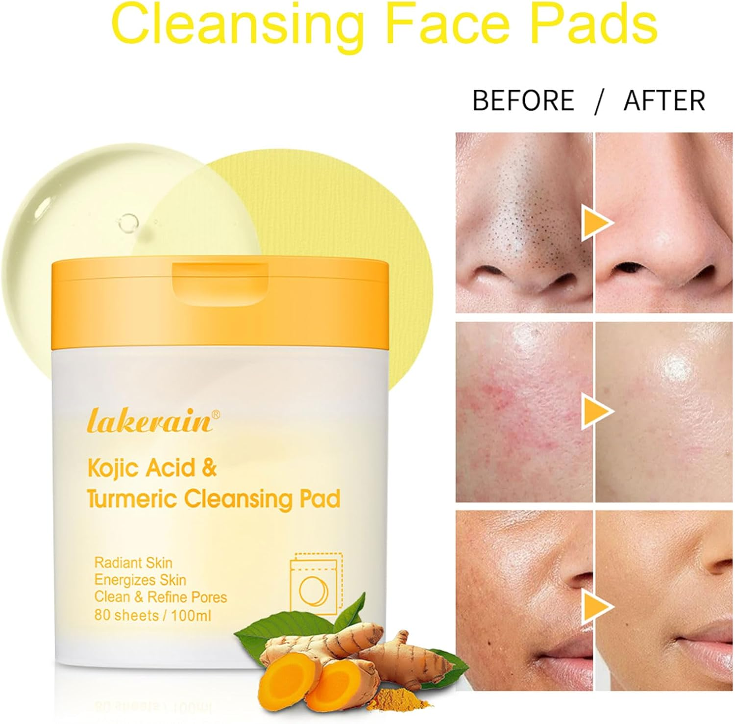 80 PCS Kojic Acid & Turmeric Cleansing Face Pads - Exfoliating, Kojic Acid Cleansing Pads for Face and Body image number 1