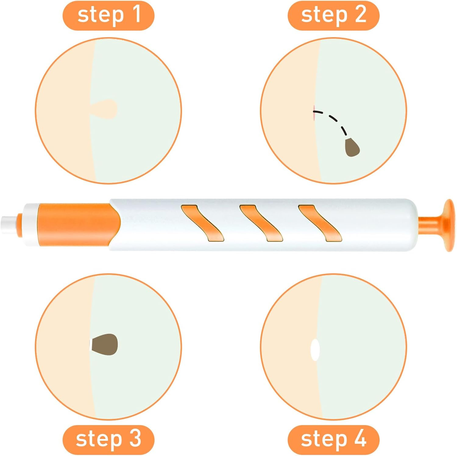 Warts Removal Pen Small Tip Single Set, Skin Tag Remover,Skin Tag Remover Pen,Wart Removal Kit, Safe and Painless, Suitable for Most Body Parts, Including Repair Patches and Cleaning Wipes image number 1