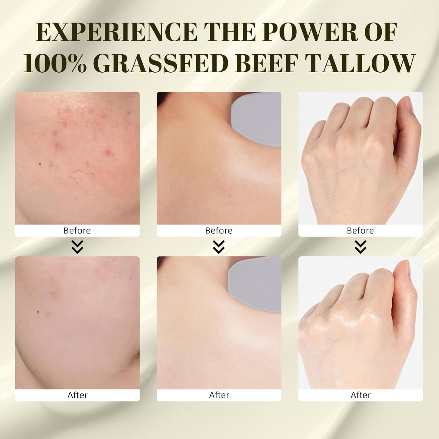 Beef Tallow for Skin, Grass Fed Beef Tallow Grass Finished Organic Tallow Face Moisturizer, Beef Tallow, Beef Tallow Balm Whipped Tallow Face Cream Moisturizer for Body Lotion Skin Care (1.7OZ) image number 5