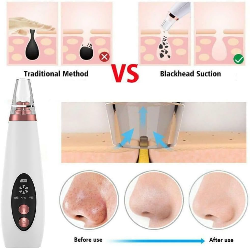Leona Co 6 in 1 Blackhead Remover Pore Vacuum, Facial Pore Cleaner-3 Suction Power, 6 Probes, USB Rechargeable Blackhead Vacuum Kit Electric Acne Extractor Tool for Women image number 3