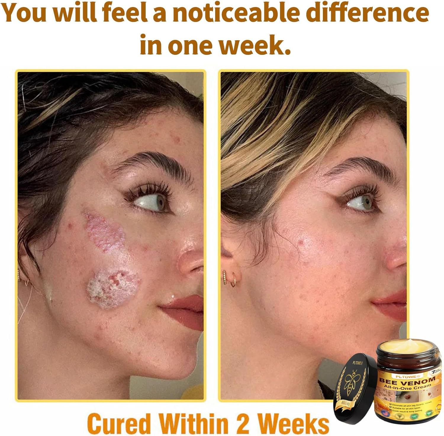 PLTOWE Bee Venom All-In-One Cream,Bee Venom Cream,Tlopa Bee Venom Skin Treatment Cream,Improve Skin Quality and Resolve Skin Problems (3) image number 2