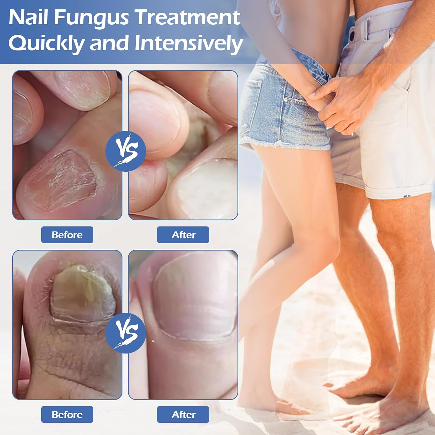 Nail Fungus Laser Treatment Device, Rechargeable Nail Fungus Laser for Fingers and Toenails, Portable Nail Cleaning Care Device, Highly Effective Nail Fungus Treatment (B) image number 3