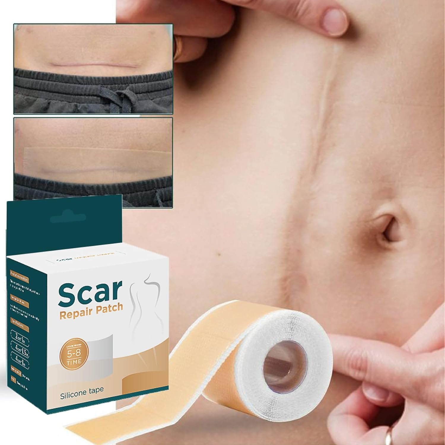 Silicone Scar Sheets Roll (1.6&rdquo;X60&rdquo; | 4Cmx150Cm) Medical Grade Reusable & Waterproof Scar Removal Patch Scar Tape for Keloid C-Section Burns and Acne Scars image number 1