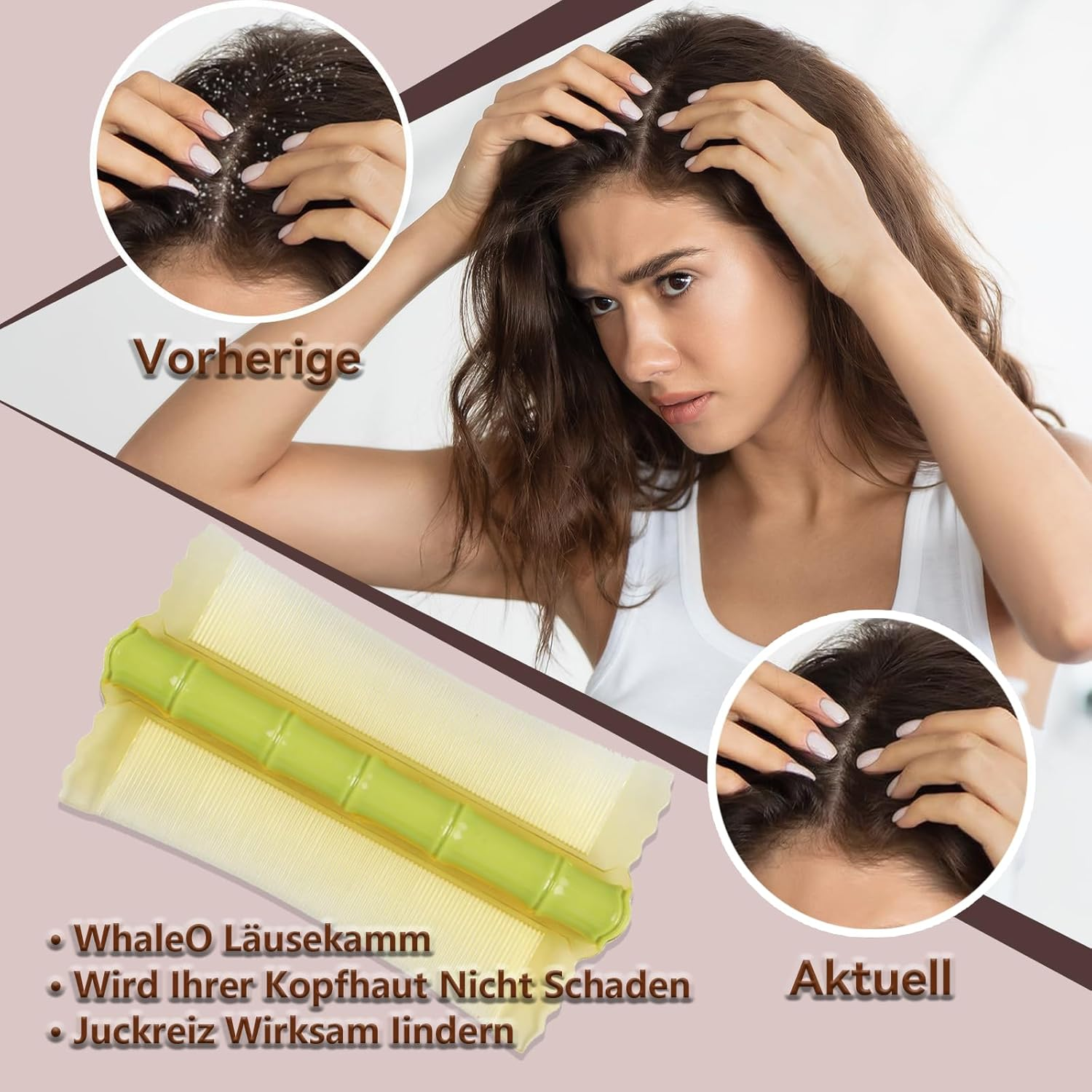 Whaleo 2 Pieces Lice and Nits Comb Lice Comb Lice Comb Hair Comb Narrow Teeth Eliminates Lice and Nits Durable and Easy to Clean image number 1