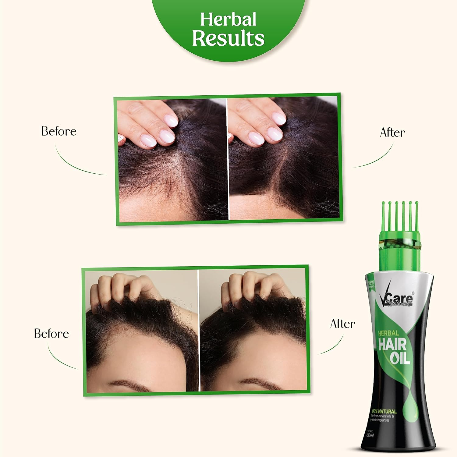 Vcare New Improved Herbal Hair Oil with Wonder Cap (100 Ml, Pack of 2) image number 4