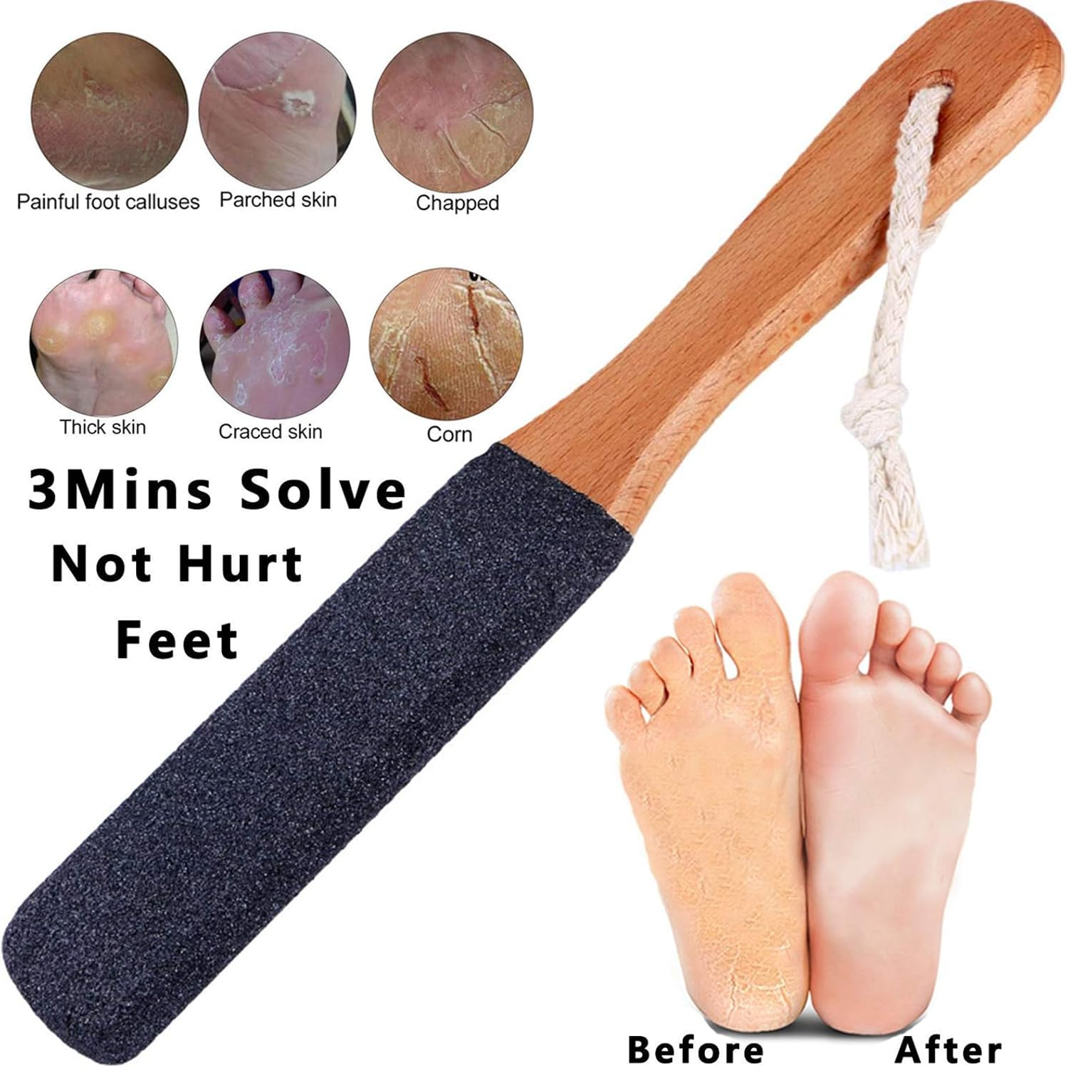 2 Pack Foot Rasp,Feet Callus Removers Foot Files Kit,Dead Skin Remover, Hygienic Pedicure Tool Foot Scrubber,For Dead,Hard Cracked Dry Skin Feet,Heels, Elbows, Hands in Shower - (Black and White) image number 3