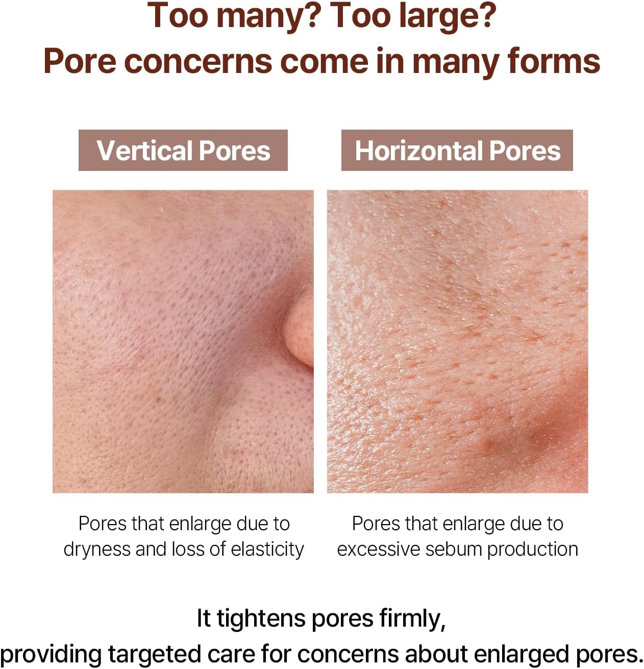 AVCA Retinol Pore Tightening Serum 100Ml &ndash; Niacinamide Oil Control, Minimizes the Look of Pores for Oily/Combination Skin, Lightweight K-Beauty image number 1