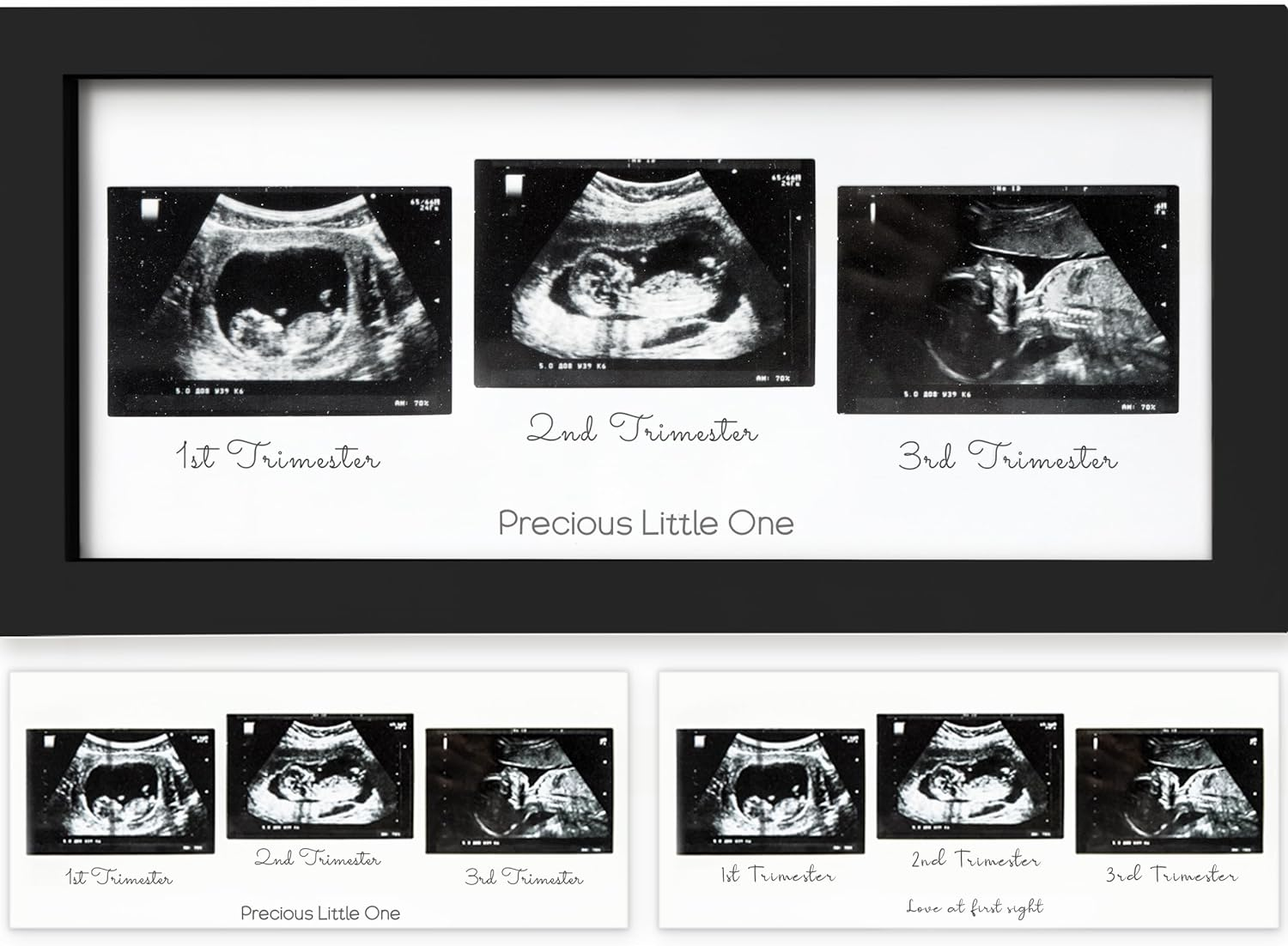 Sonogram Picture Frame - Trio Ultrasound Picture Frames for Mom to Be Gift - Baby Ultrasound Frame for Pregnancy Announcements - Baby Nursery Decor, Pregnant Mom Gifts (Alpine White)