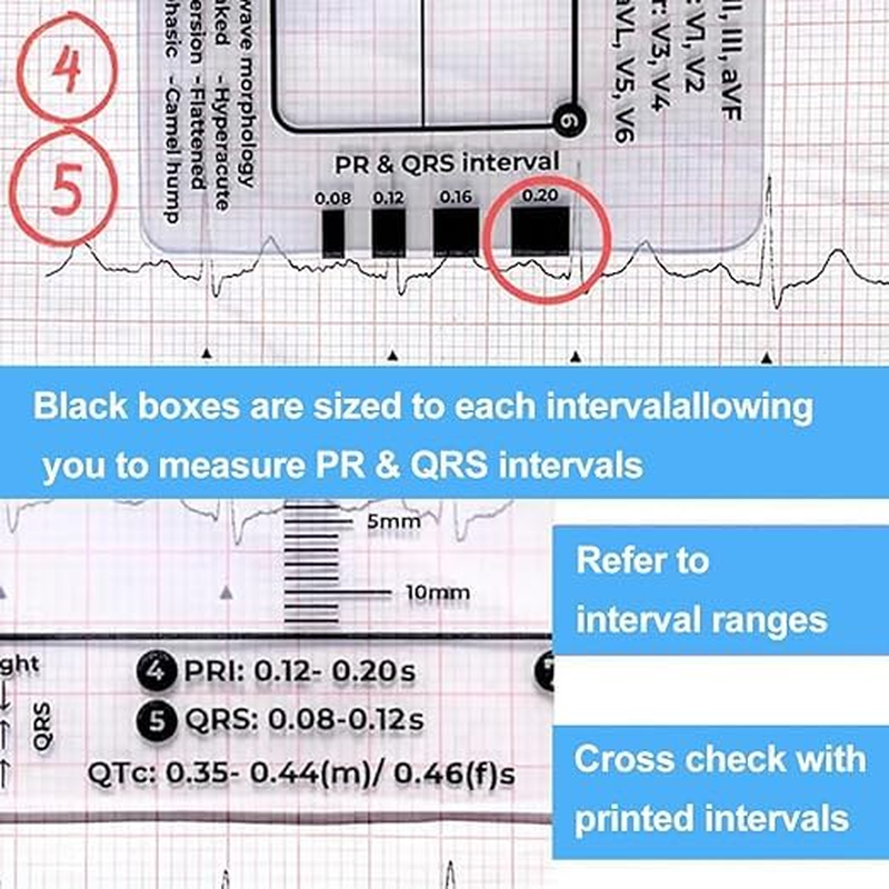 ECG 7Step Ruler,Ecg Ruler Plastic Ruler Measuring Tool,Ecg 7Step Ruler for ECG/EKG Interpretation,Transparent EKG Calipers 7Step Ruler,Follow a 7Step Plan ID Sized for Nurse or One in Healthcare (2) image number 4