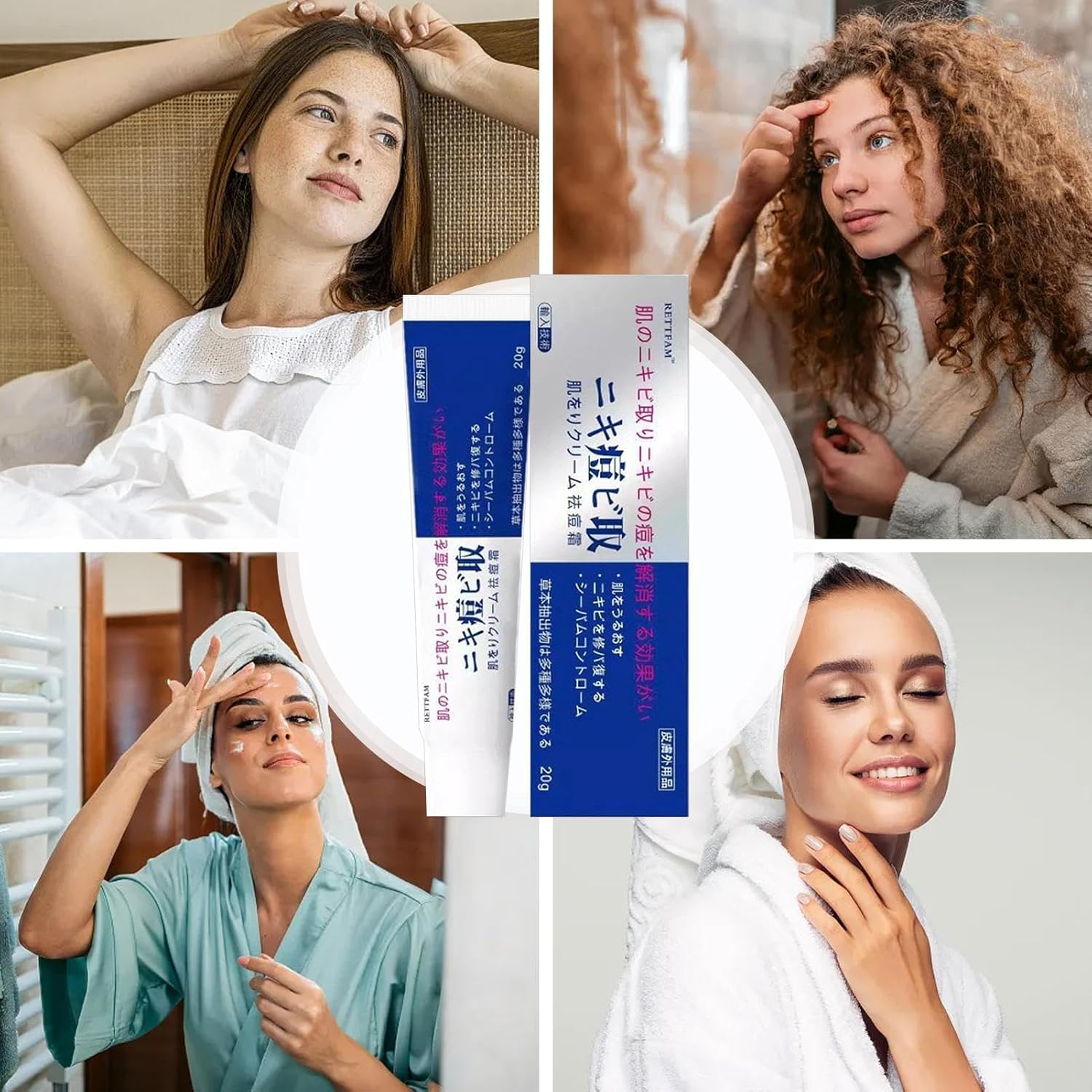 2Pcs Ac-Ne Cream - 20G Pair Ac-Ne Cream Japa, Pair Japanese Ac-Ne Cream, Long-Lasting Moisturizing, No Dryness, Ac-Ne Treat-Ment Removal Cream for Pimples Prone Skin, Mild and Harmless to Skin