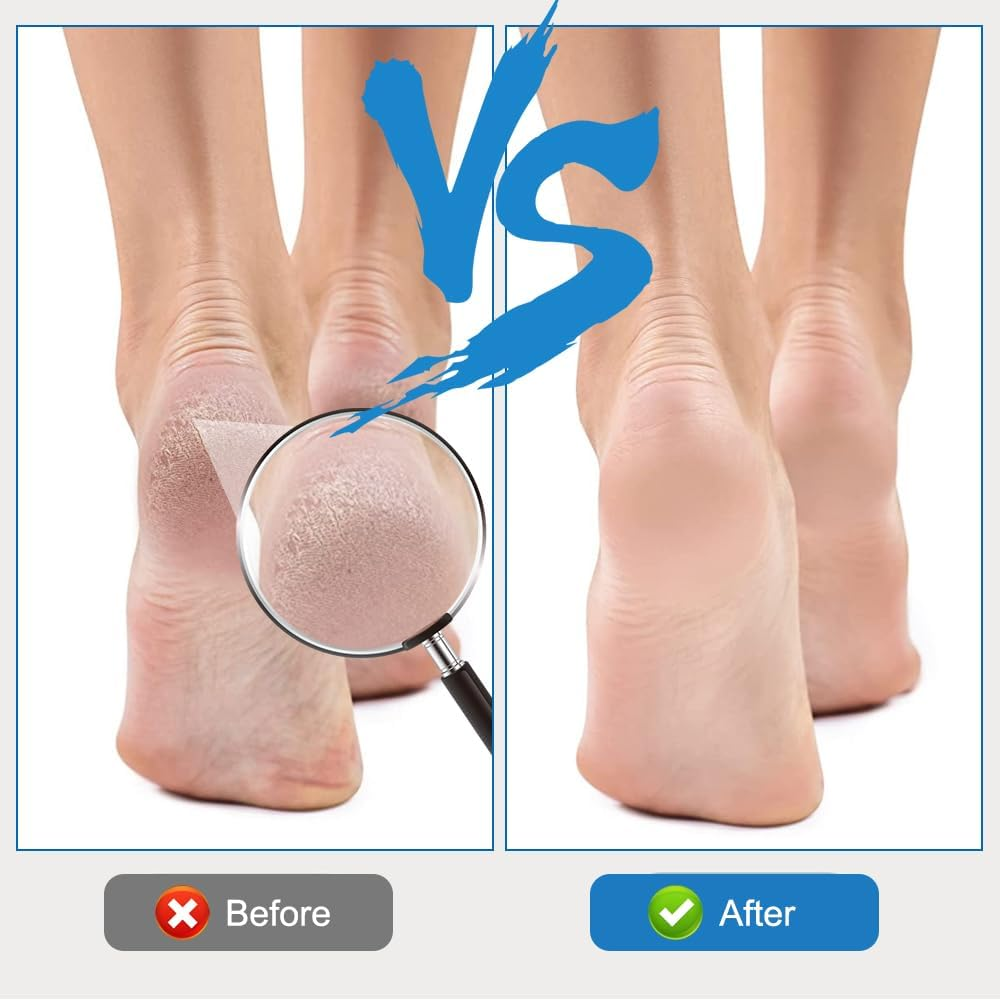 Foot File Callus Remover 16 X 3.5 Cm, Double-Sided Pedicure, Foot Callus Remover for Dry, Cracked Feet and Dead Skin (Blue) Pack of 10 image number 4